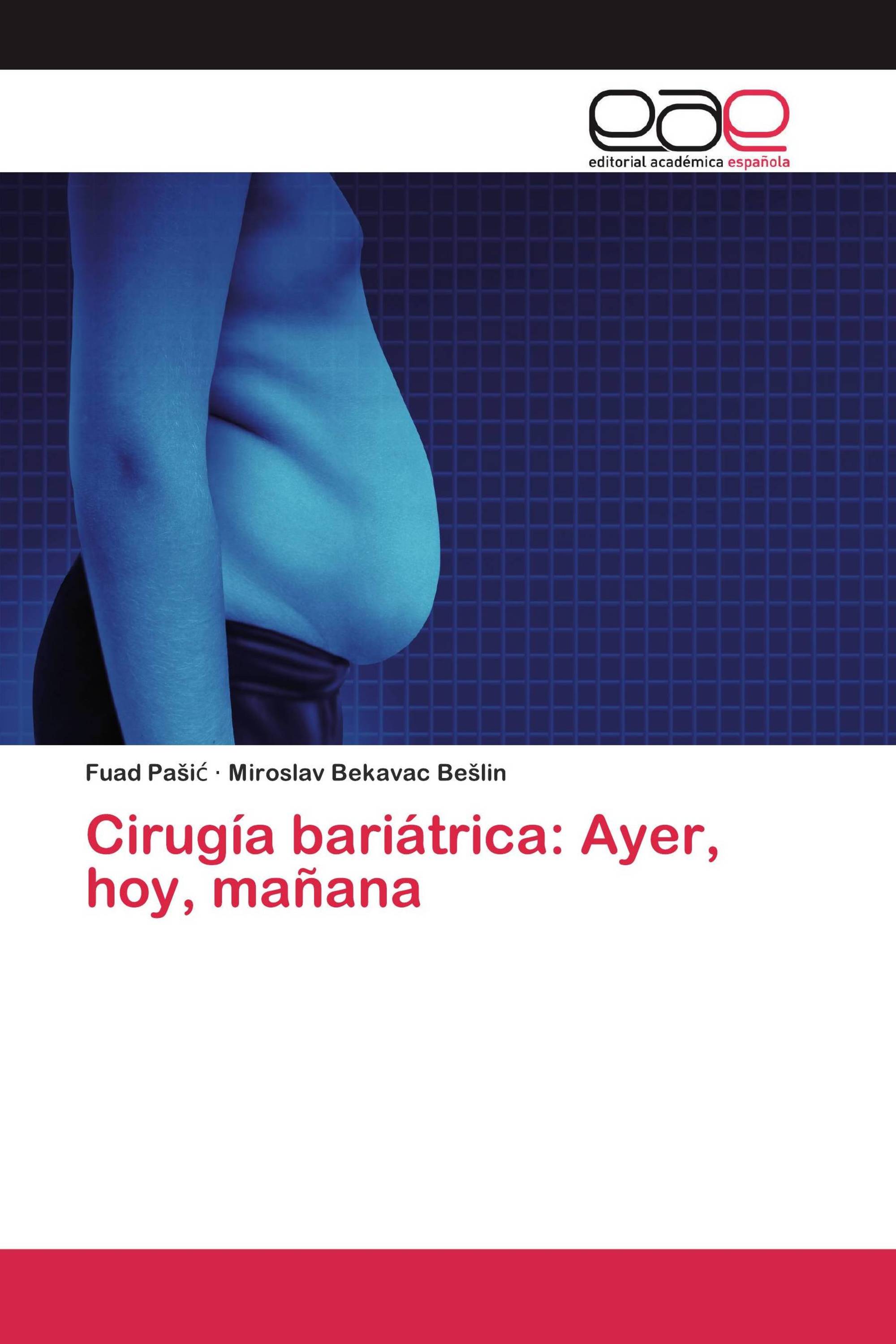 Cirugía bariátrica: Ayer, hoy, mañana