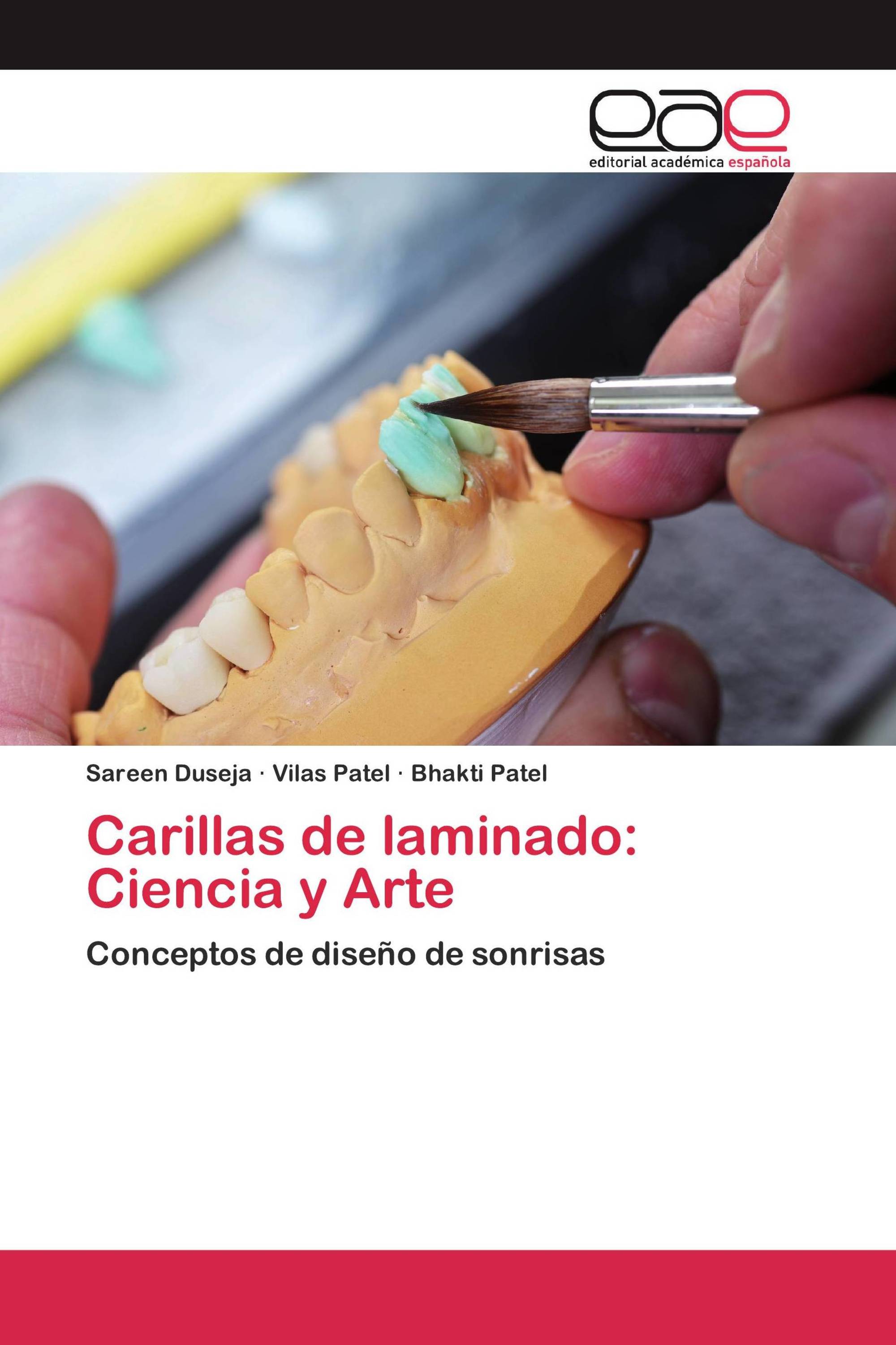 Carillas de laminado: Ciencia y Arte