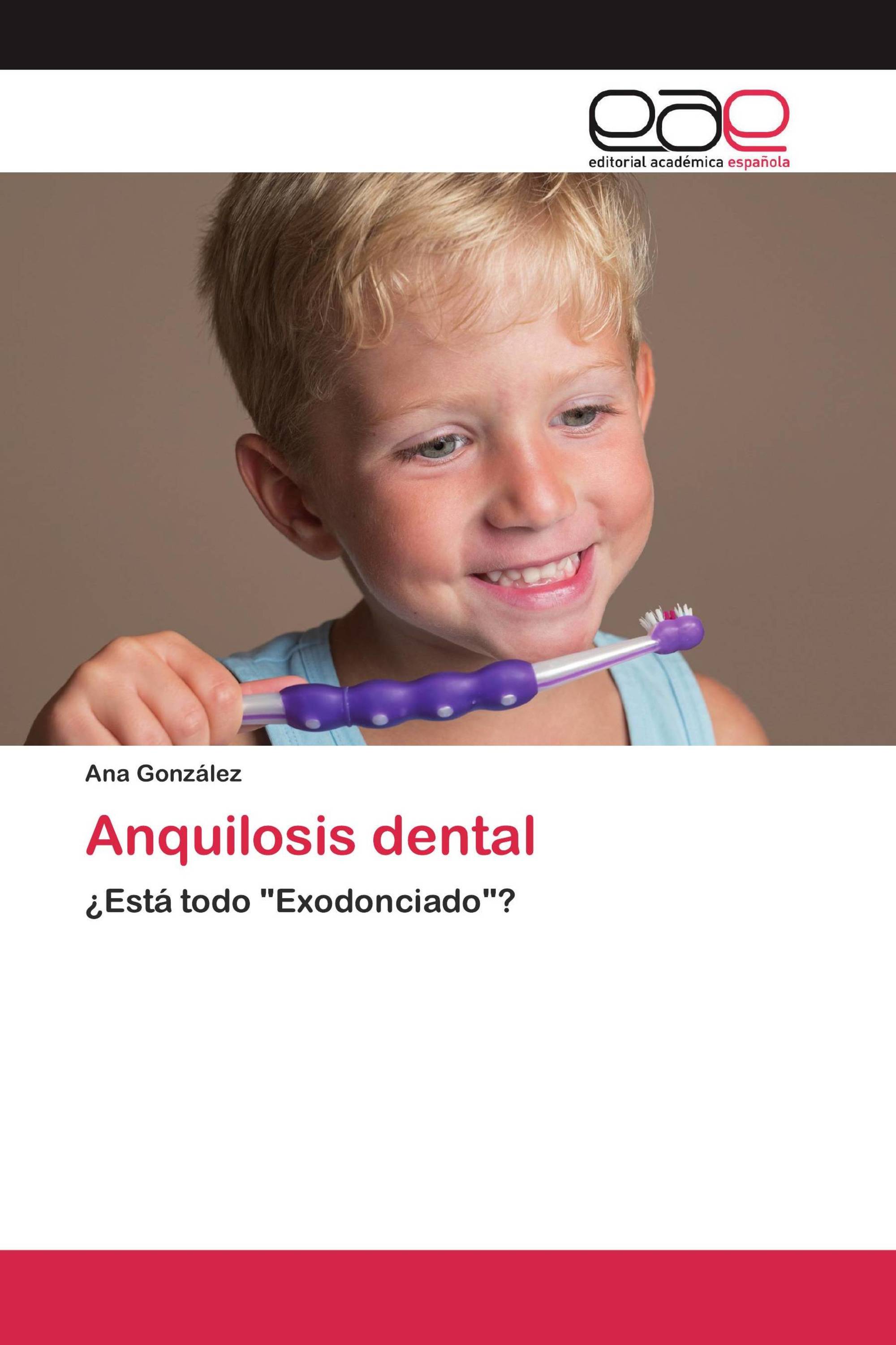 Anquilosis dental