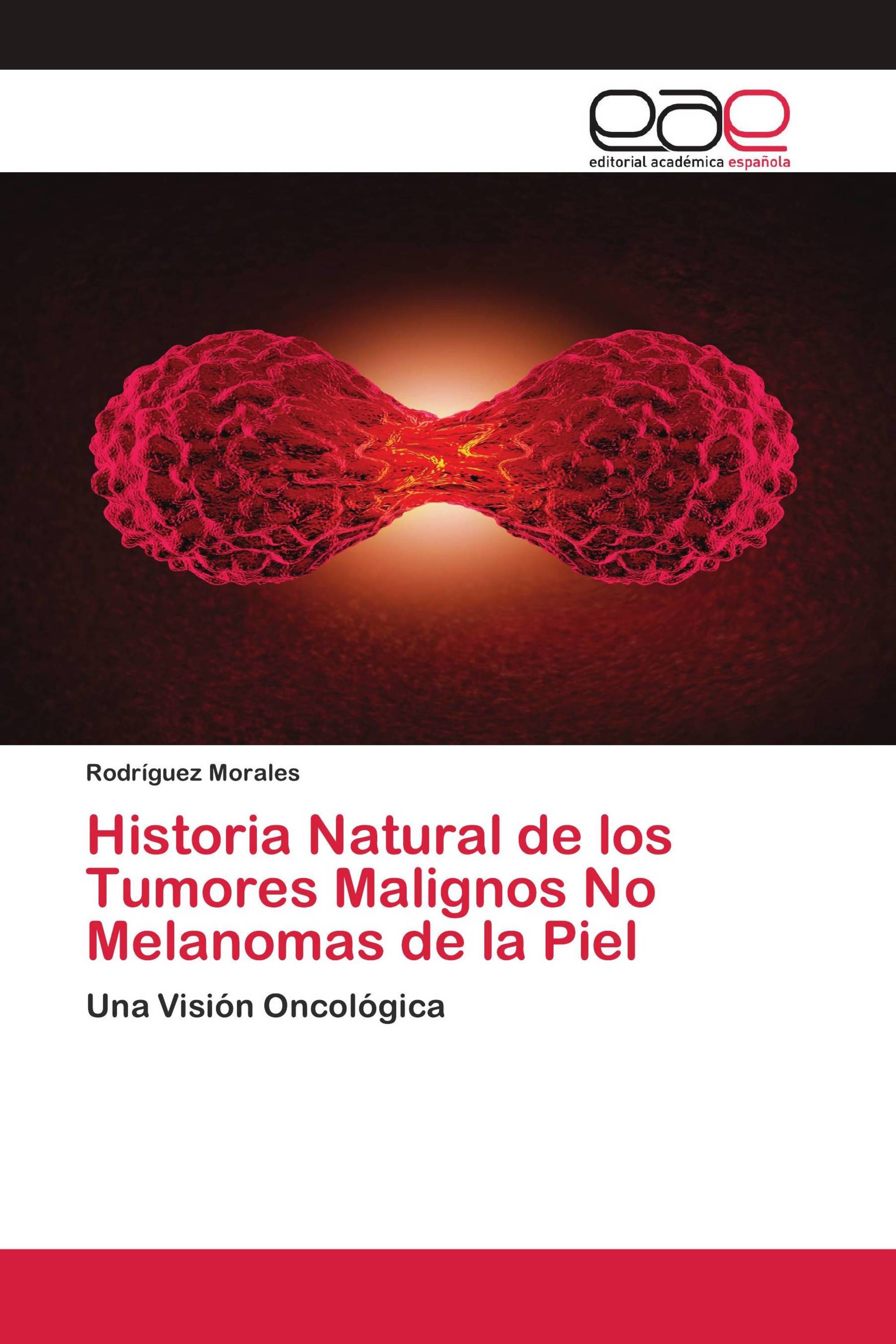 Historia Natural de los Tumores Malignos No Melanomas de la Piel