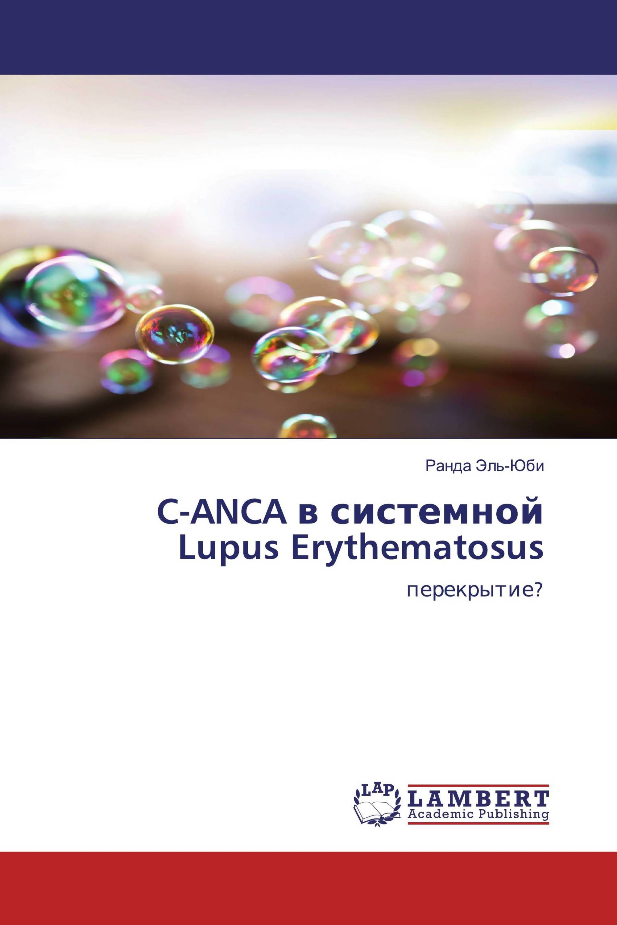 C-ANCA в системной Lupus Erythematosus