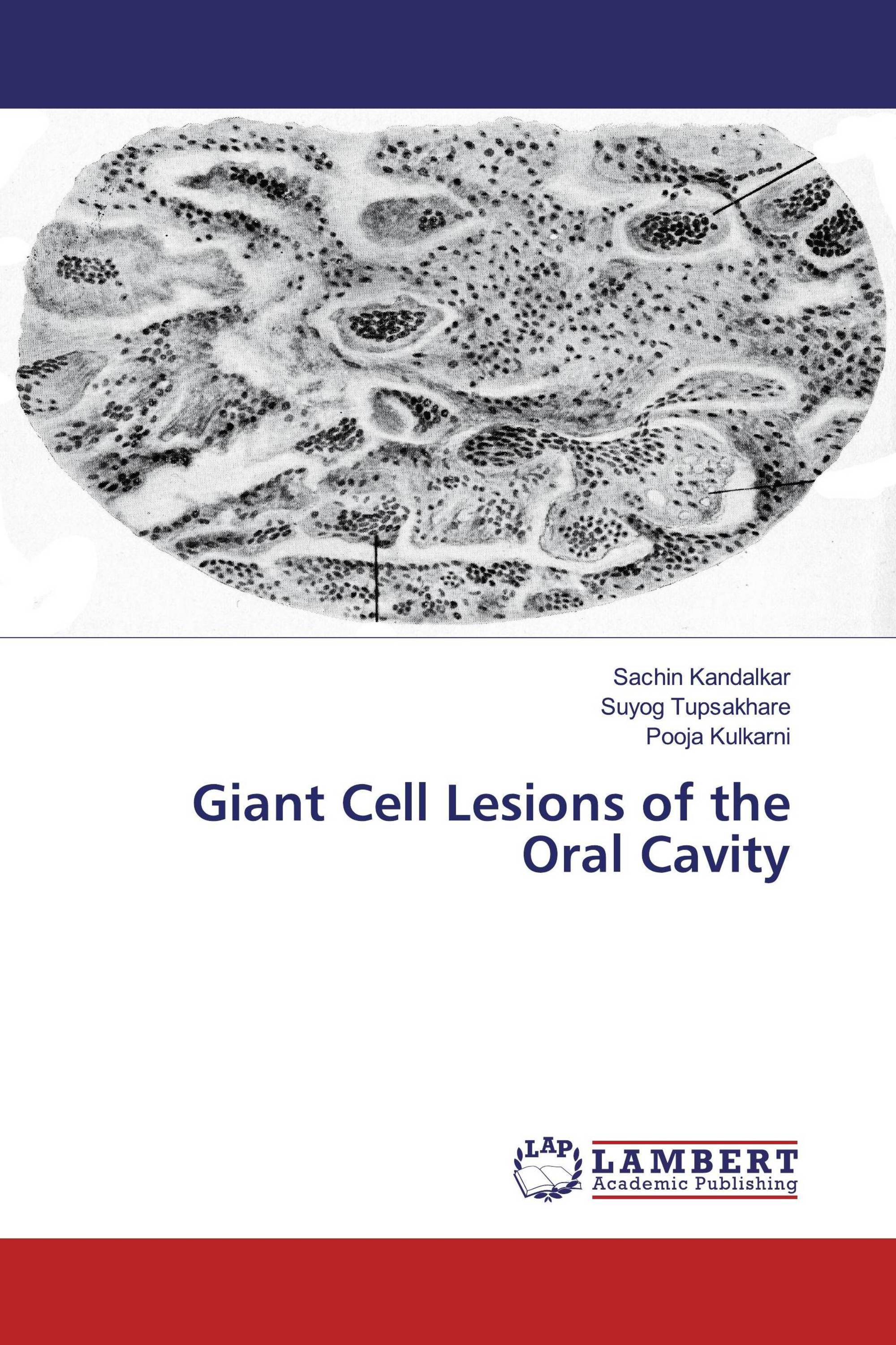 Giant Cell Lesions of the Oral Cavity