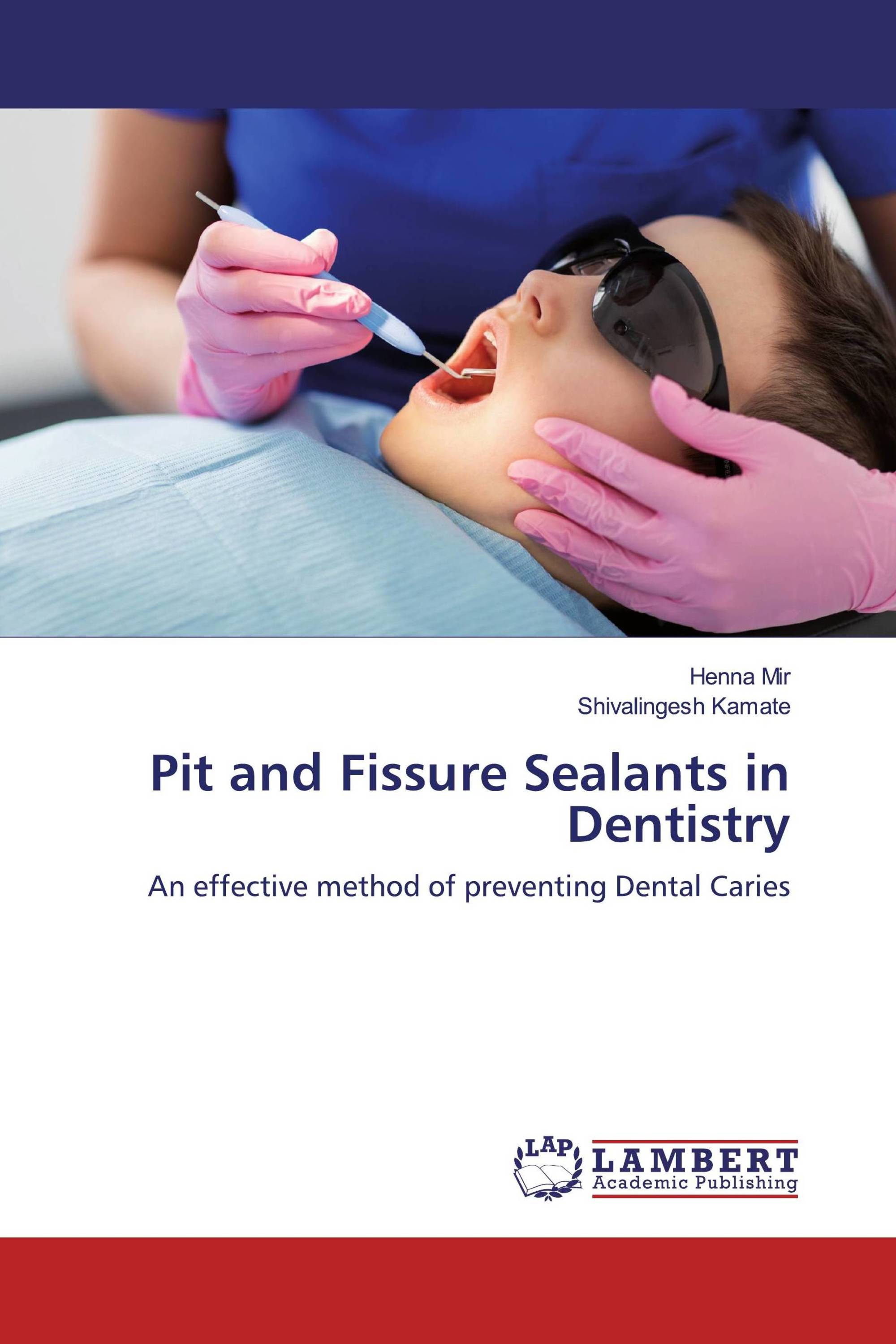 Pit and Fissure Sealants in Dentistry