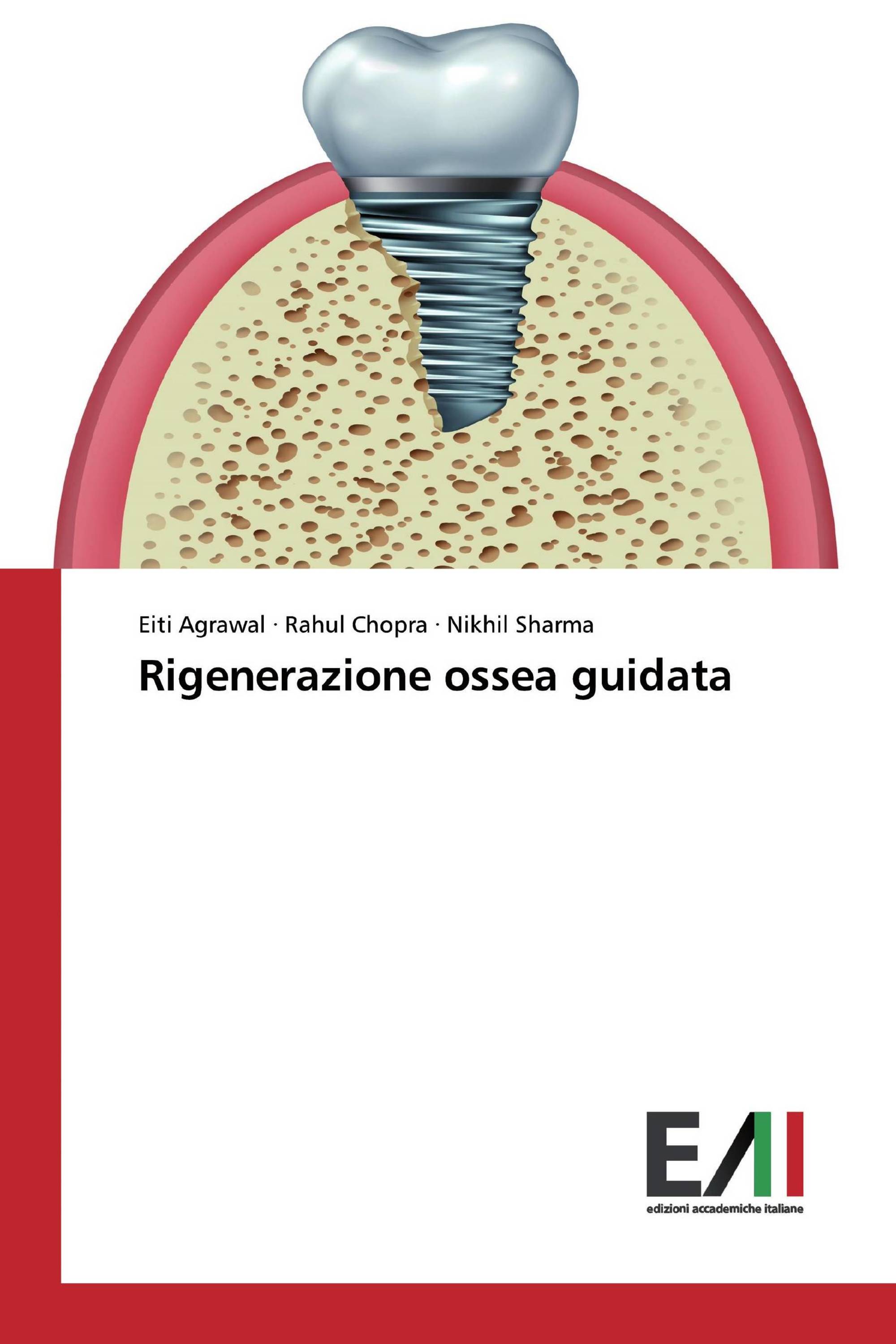 Rigenerazione ossea guidata