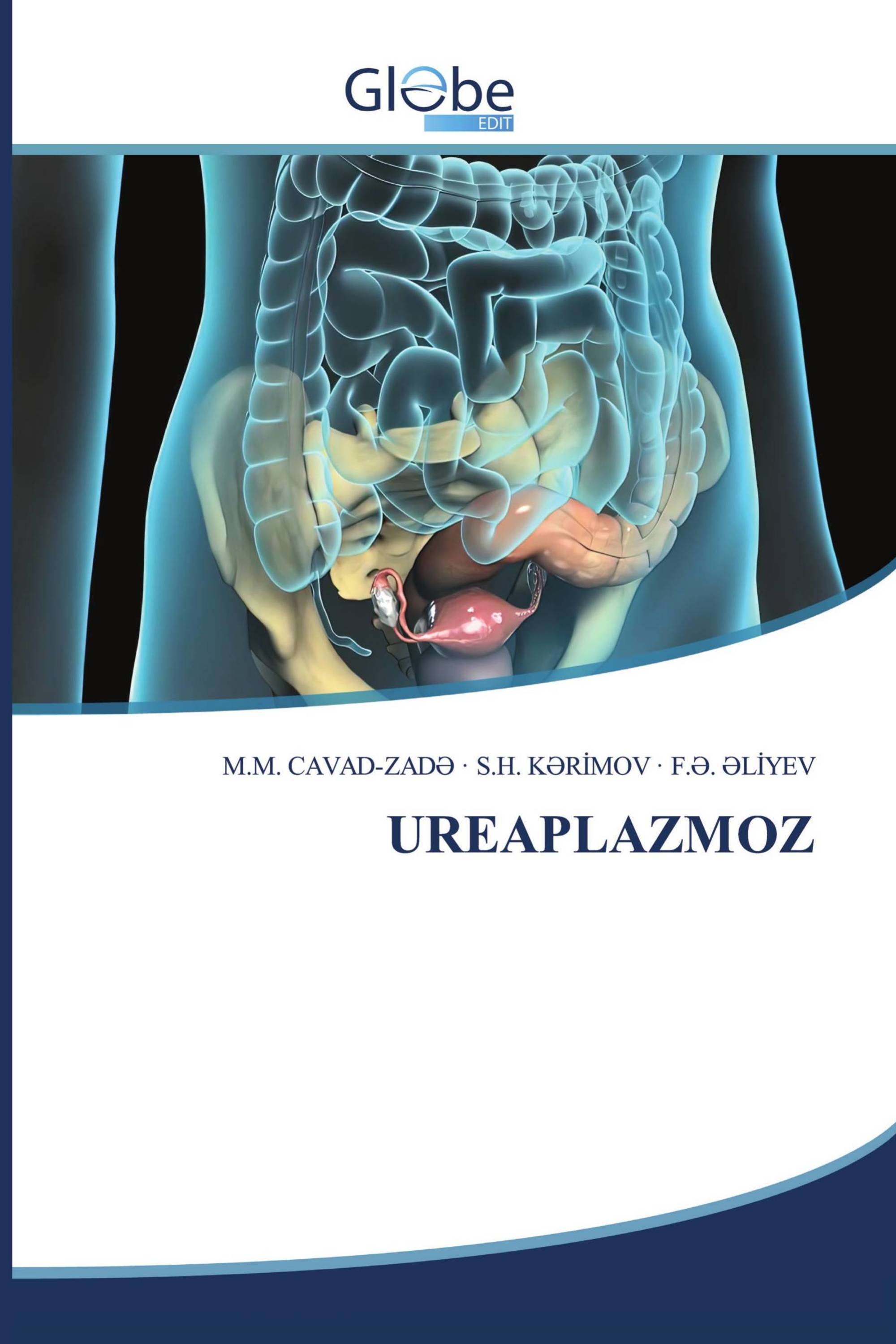 UREAPLAZMOZ