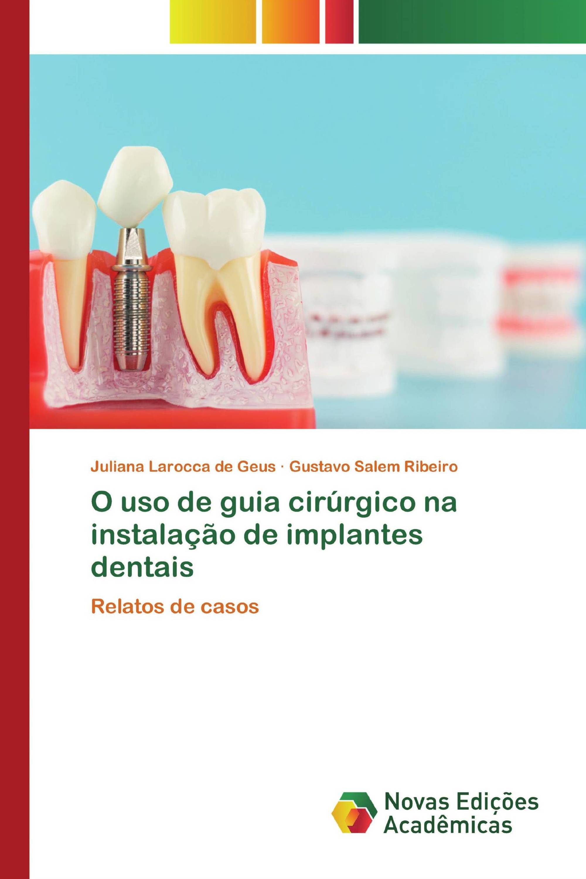 O uso de guia cirúrgico na instalação de implantes dentais