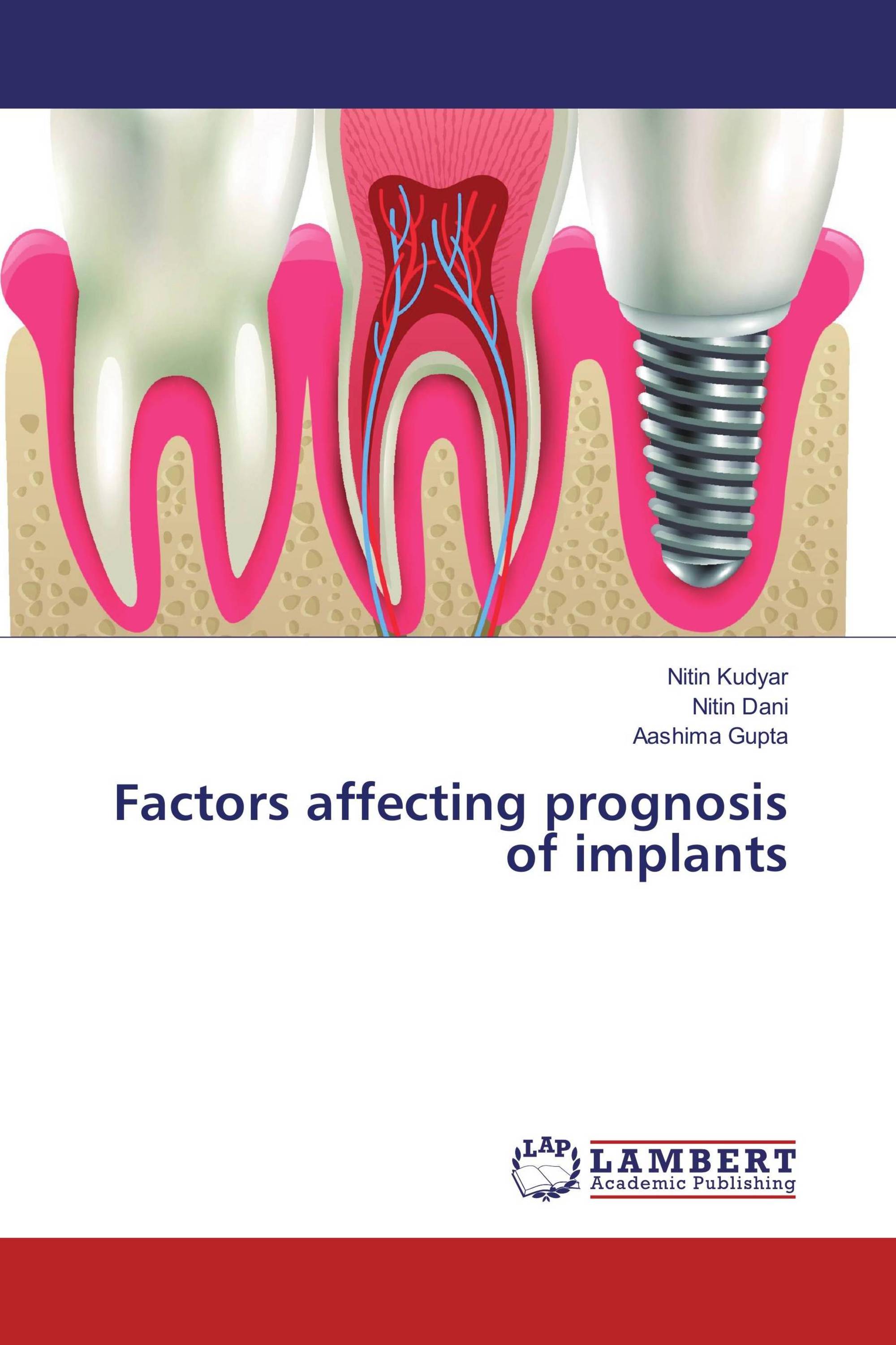 Factors affecting prognosis of implants