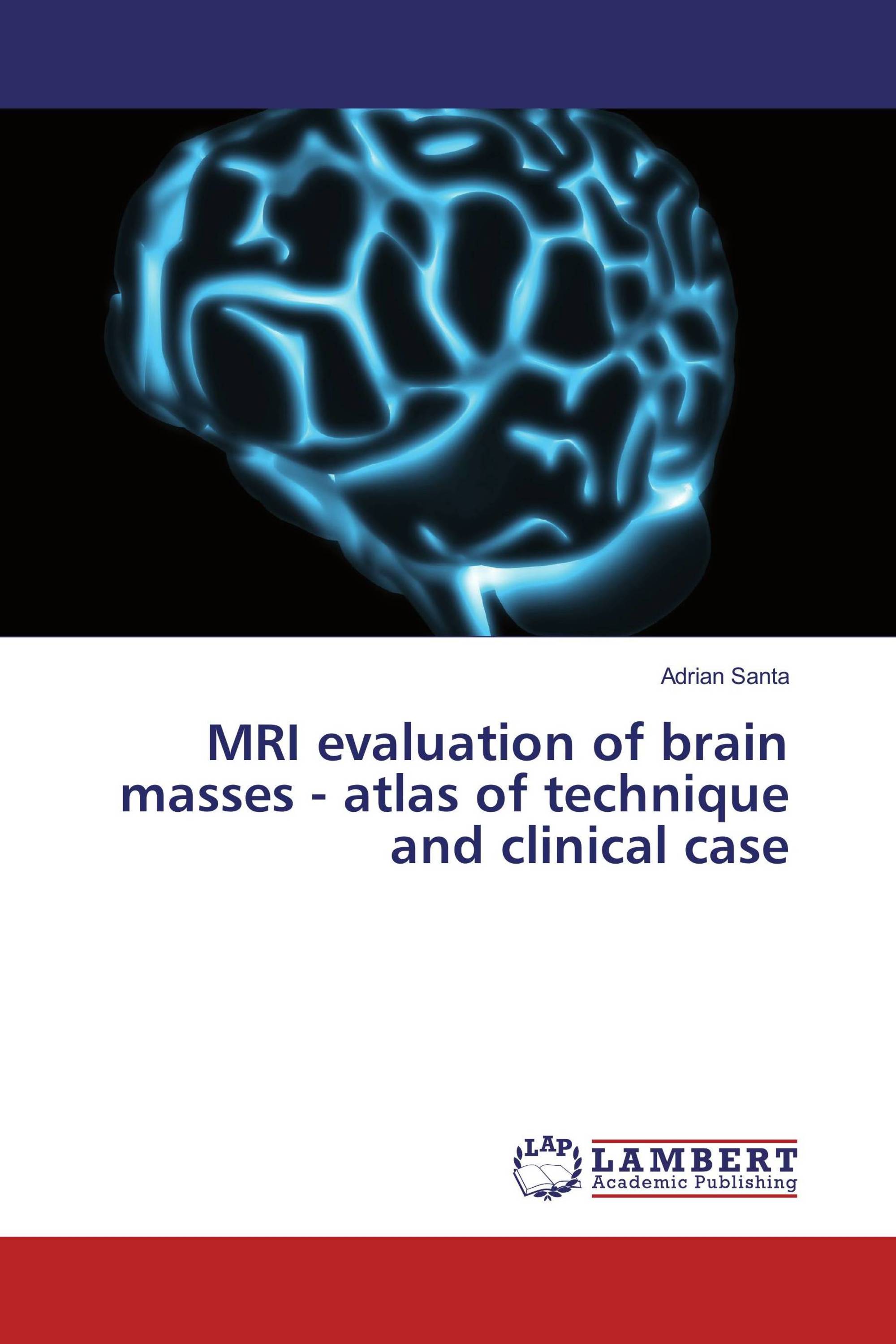 MRI evaluation of brain masses - atlas of technique and clinical case