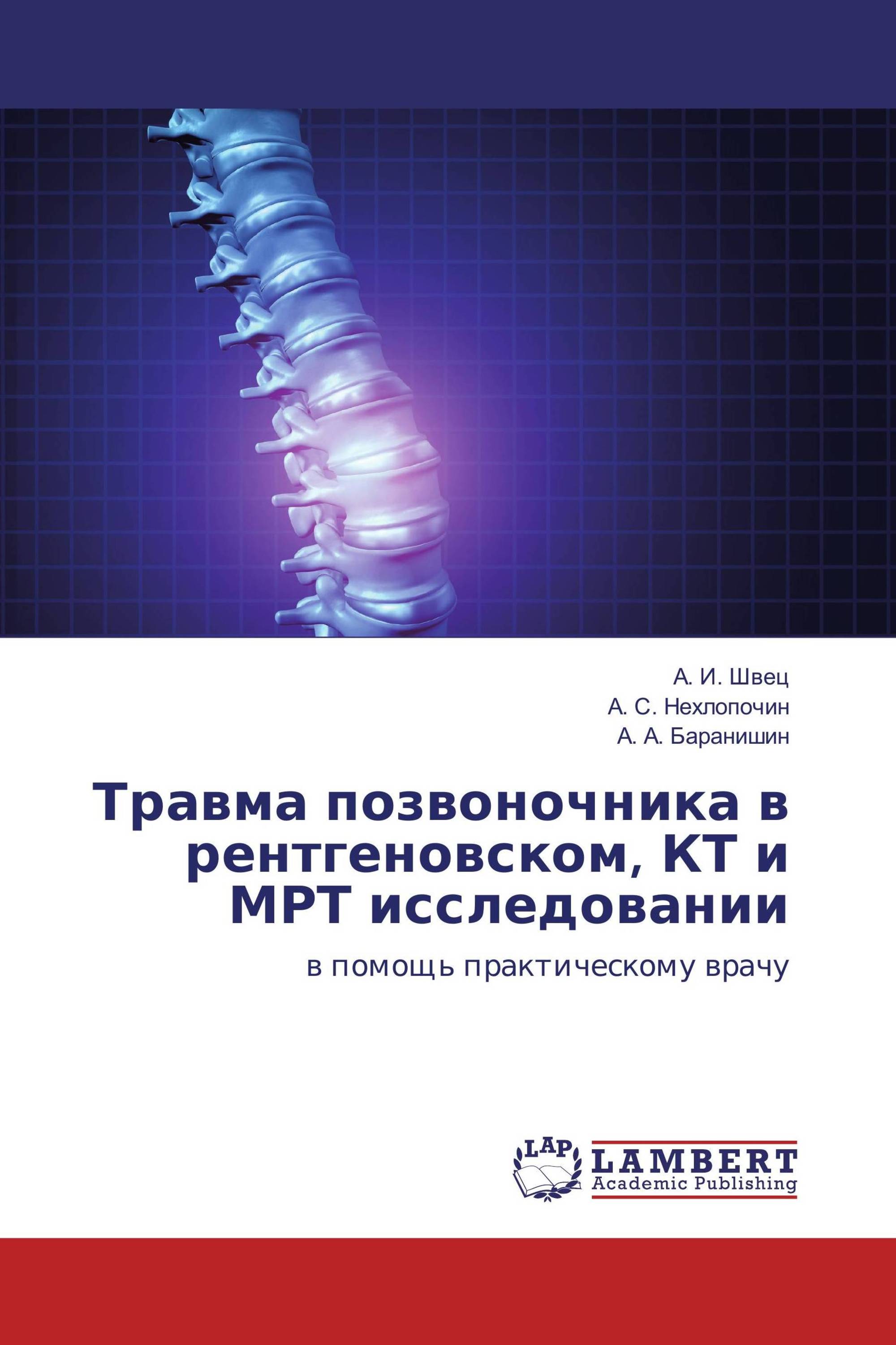 Травма позвоночника в рентгеновском, КТ и МРТ исследовании