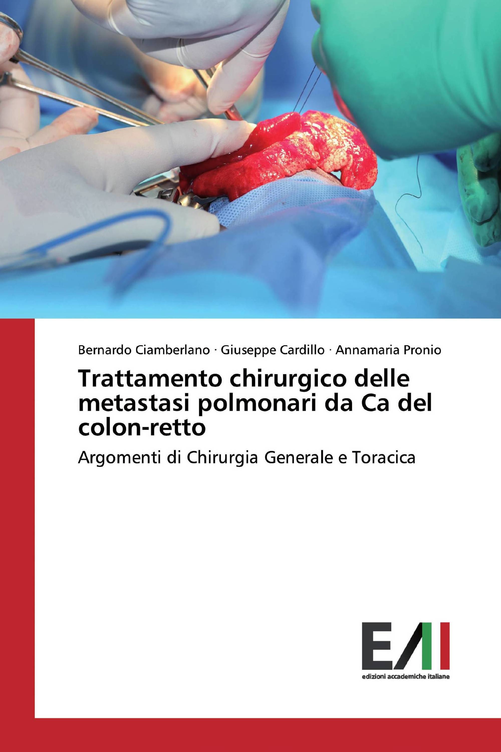 Trattamento chirurgico delle metastasi polmonari da Ca del colon-retto