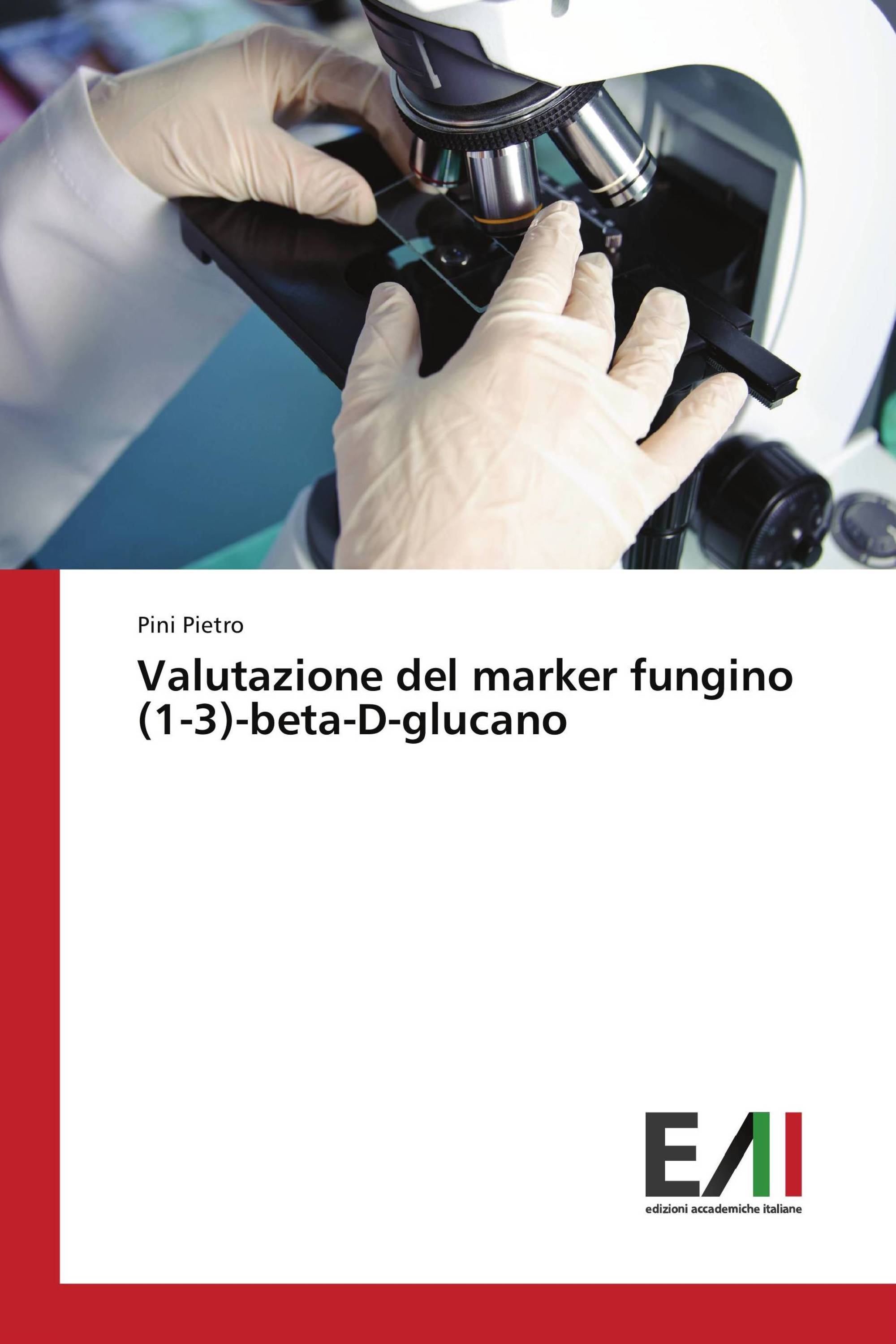 Valutazione del marker fungino (1-3)-beta-D-glucano