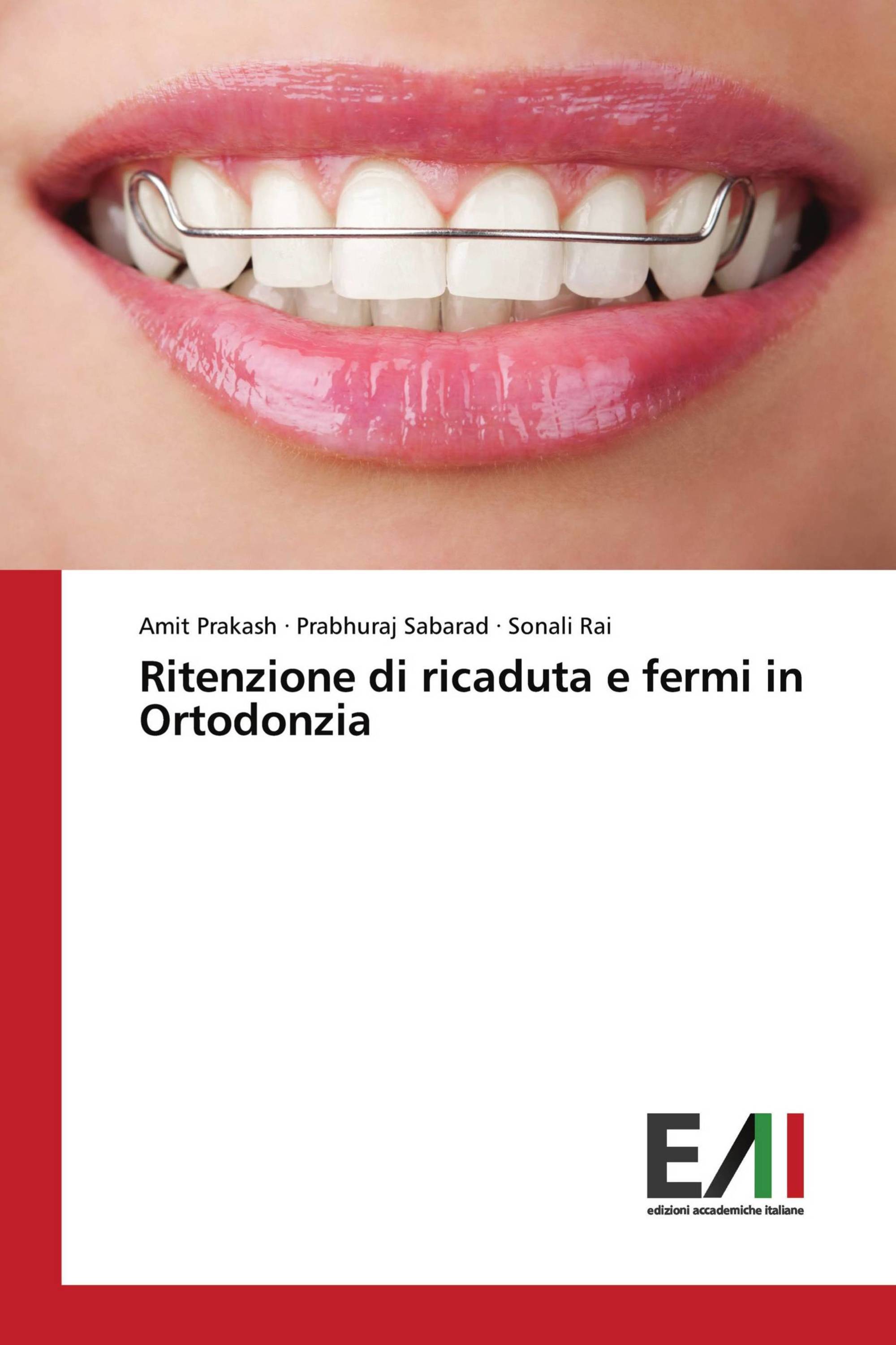 Ritenzione di ricaduta e fermi in Ortodonzia