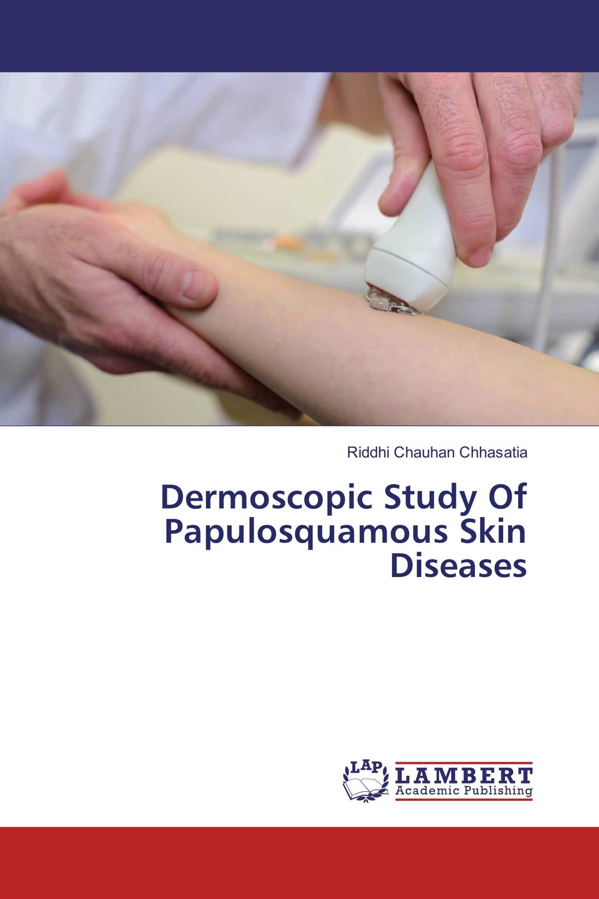 Dermoscopic Study Of Papulosquamous Skin Diseases