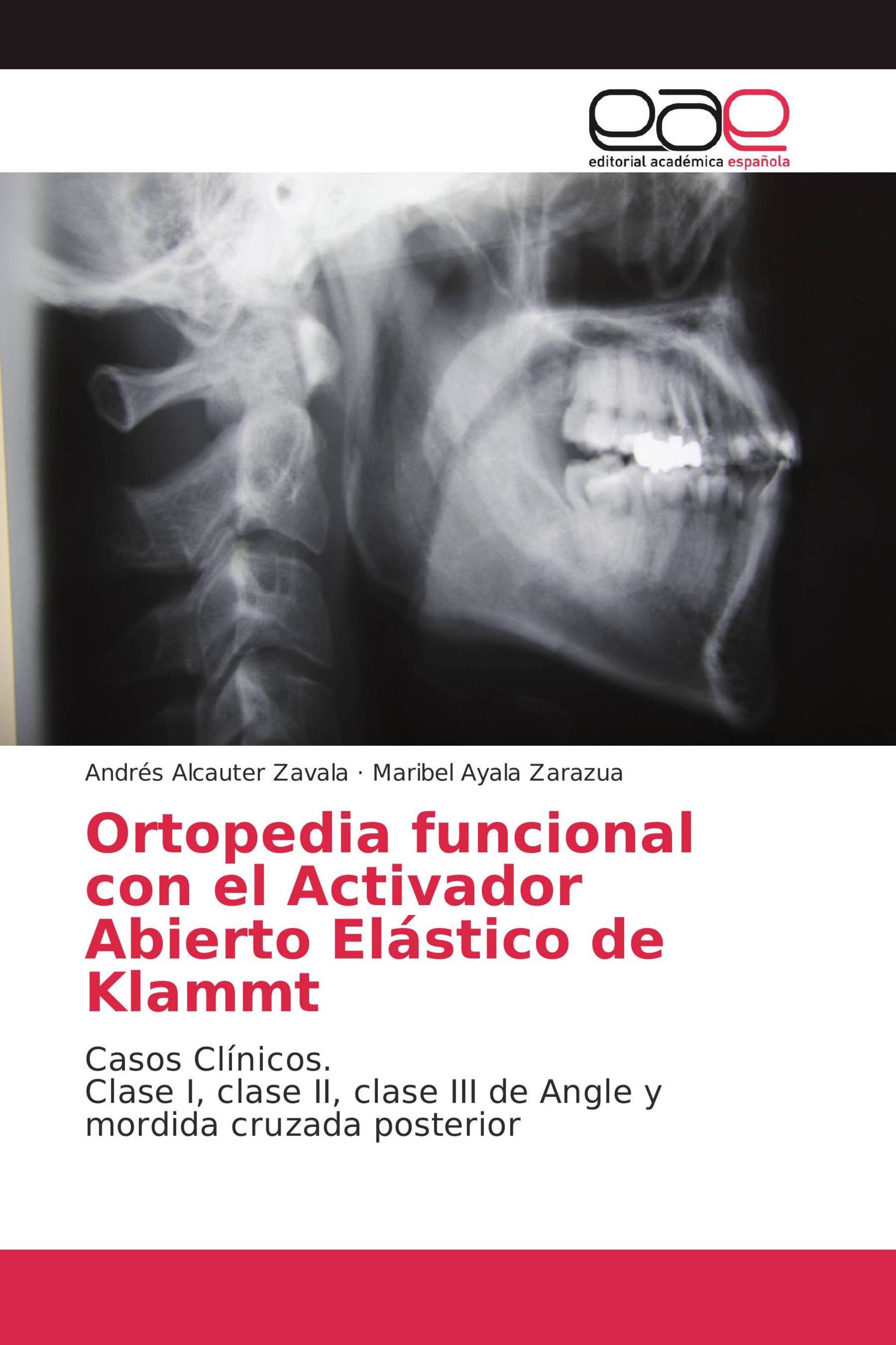 Ortopedia funcional con el Activador Abierto Elástico de Klammt