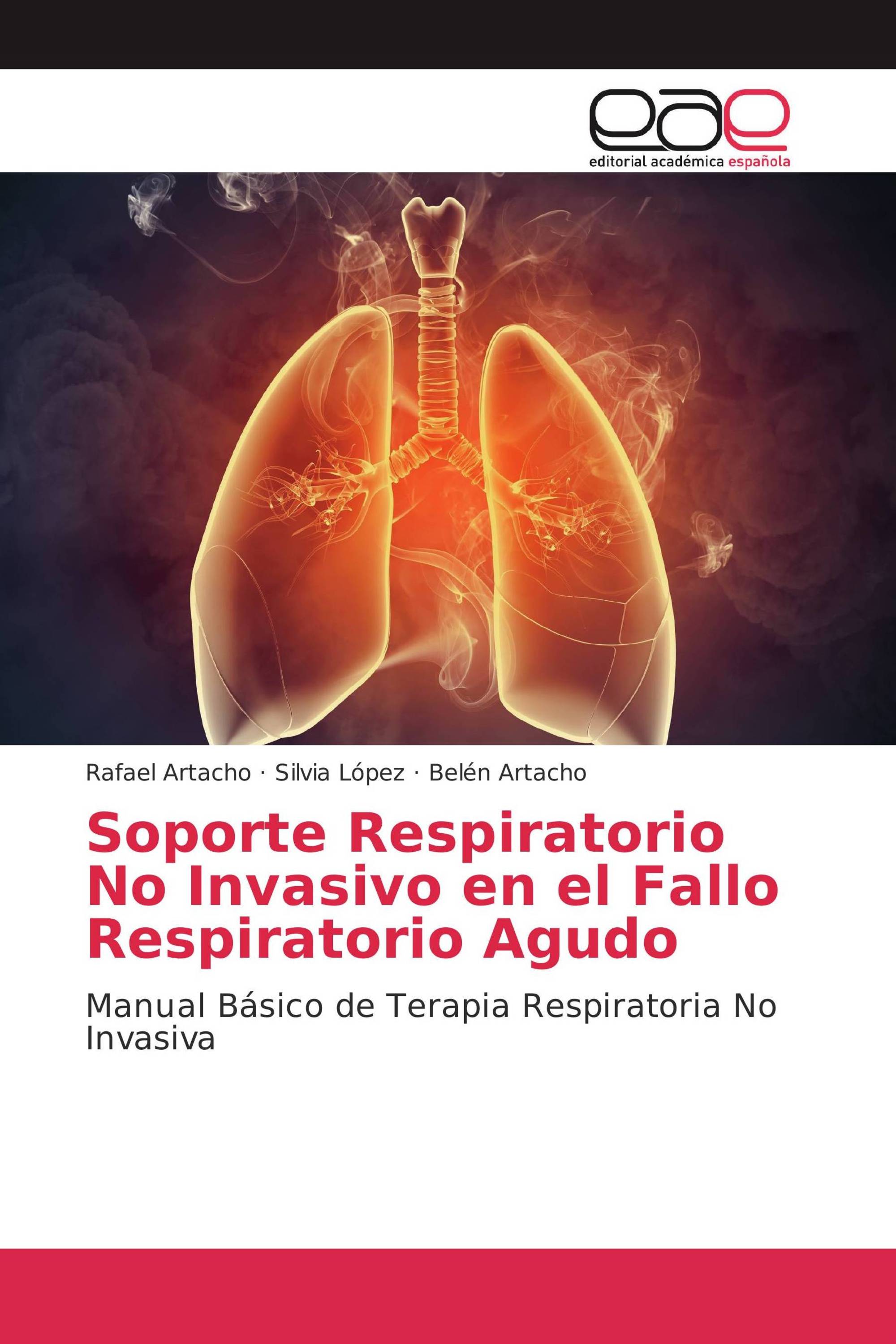 Soporte Respiratorio No Invasivo en el Fallo Respiratorio Agudo