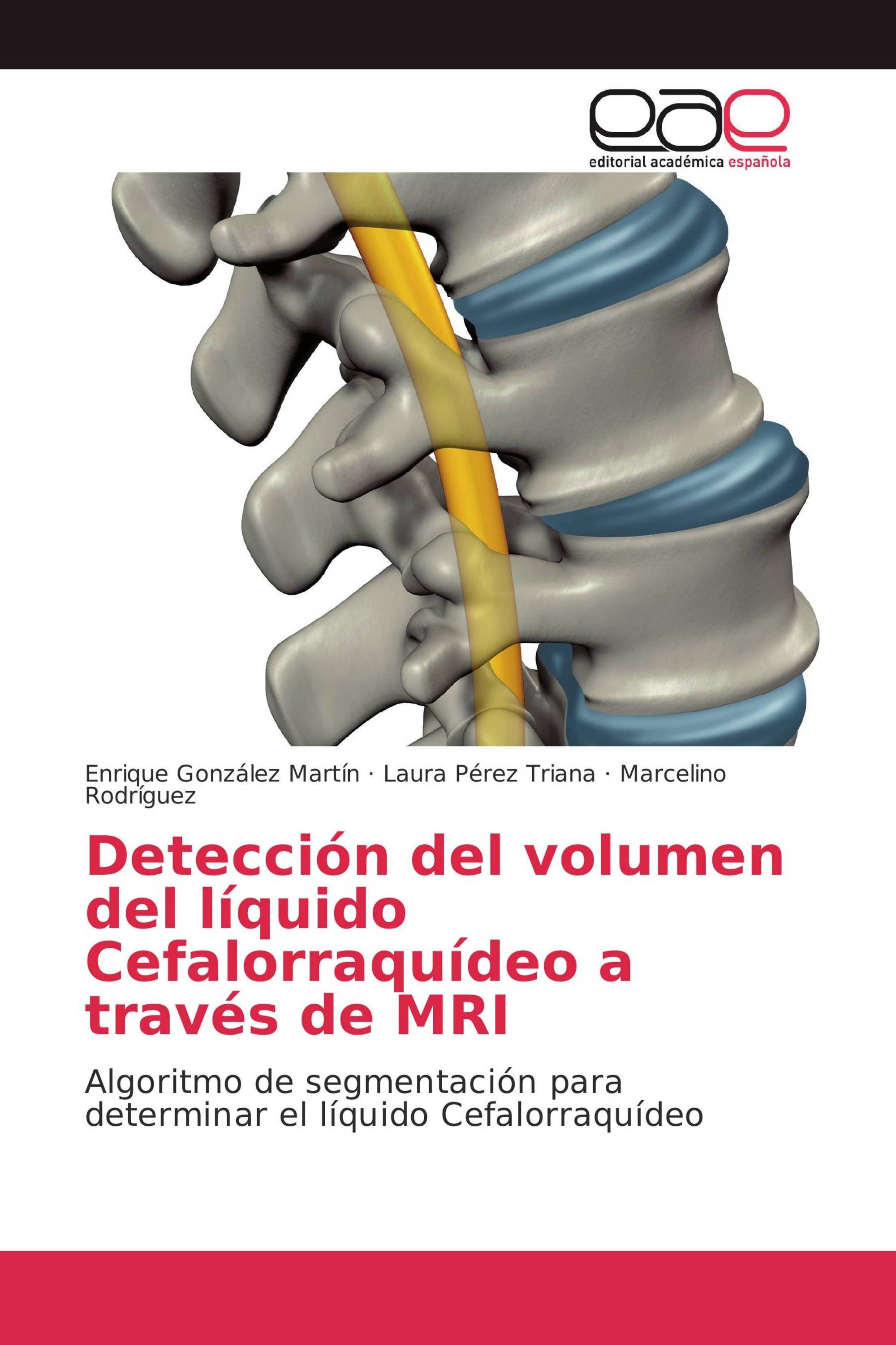 Detección del volumen del líquido Cefalorraquídeo a través de MRI