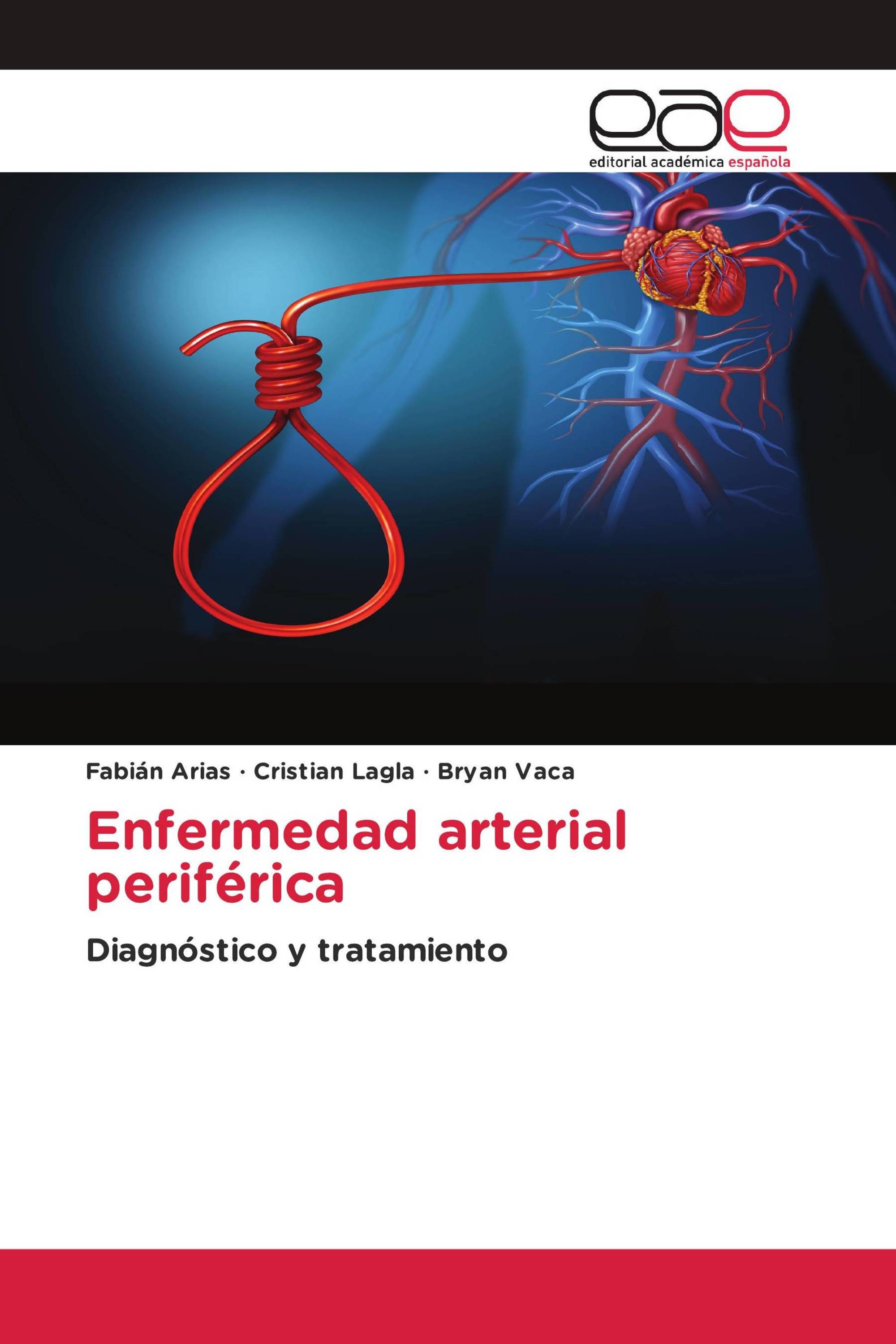 Enfermedad arterial periférica