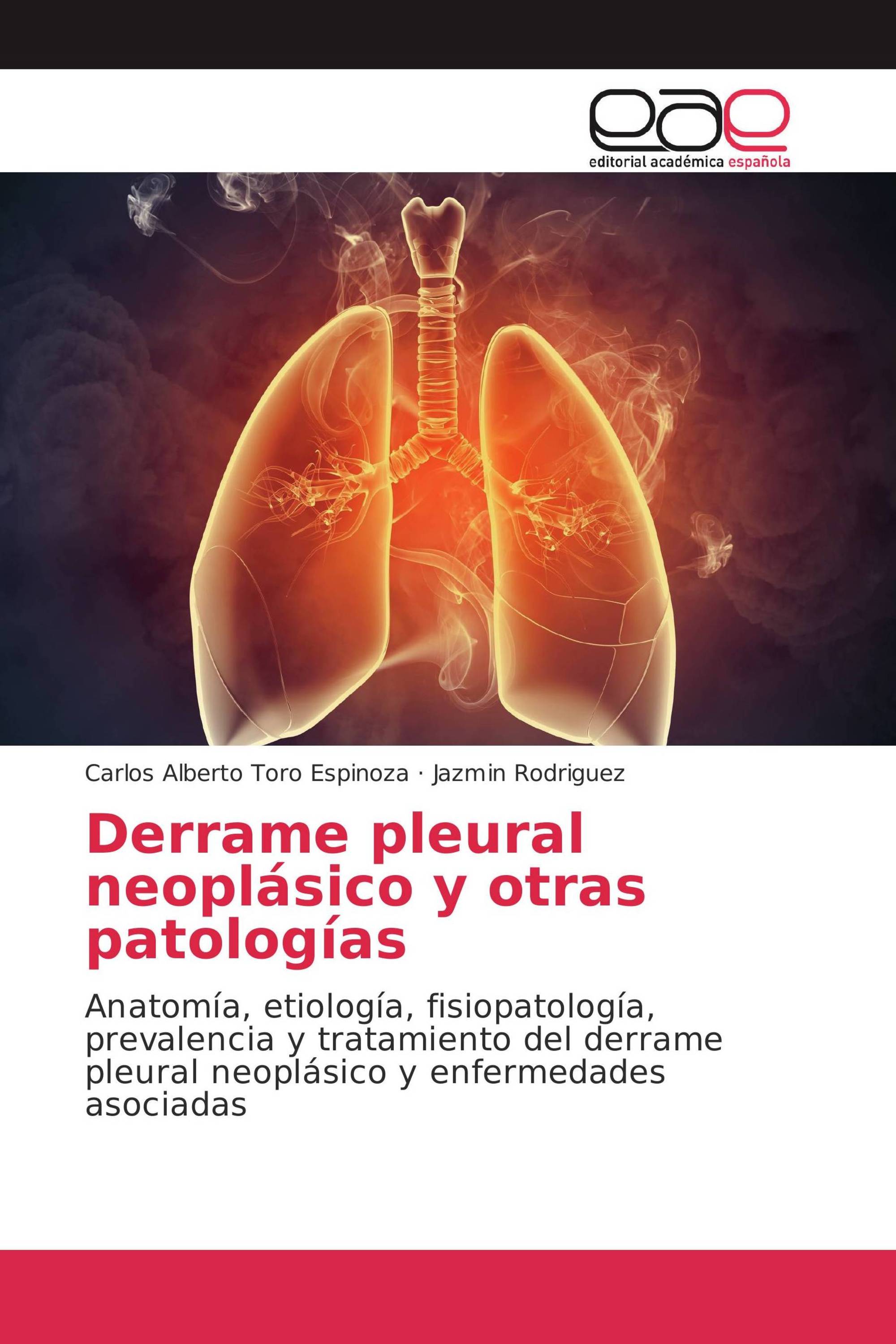 Derrame pleural neoplásico y otras patologías