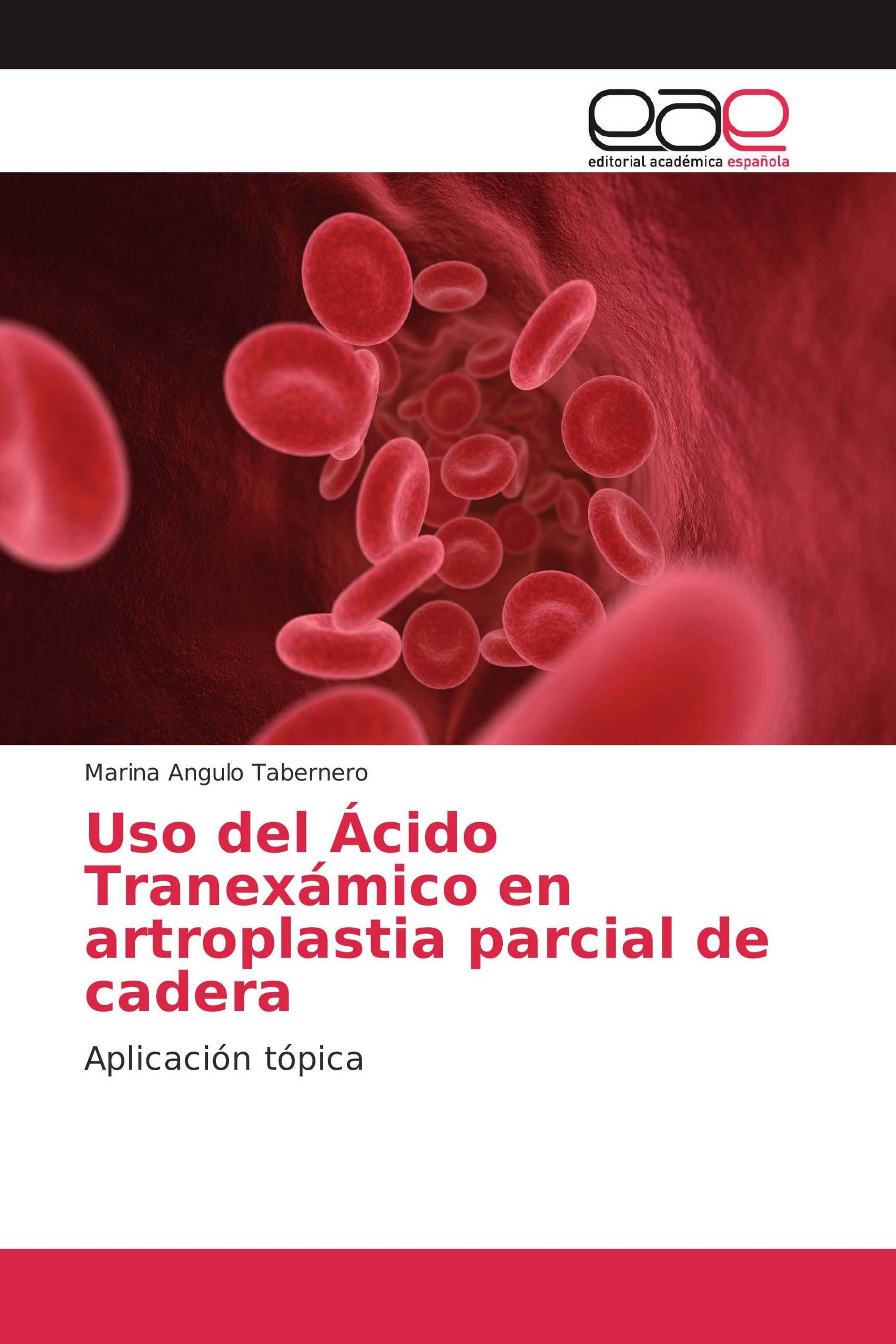 Uso del Ácido Tranexámico en artroplastia parcial de cadera