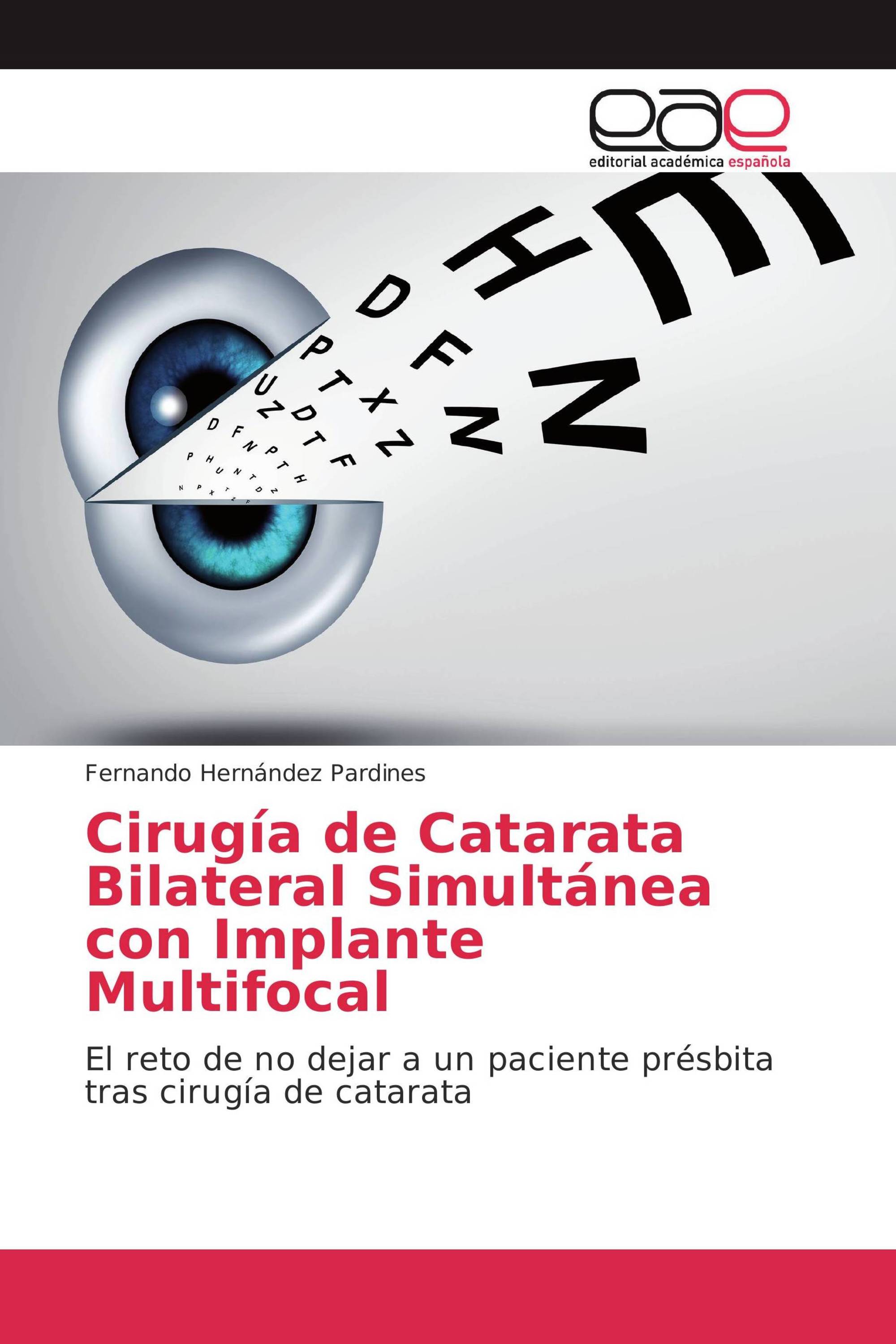 Cirugía de Catarata Bilateral Simultánea con Implante Multifocal