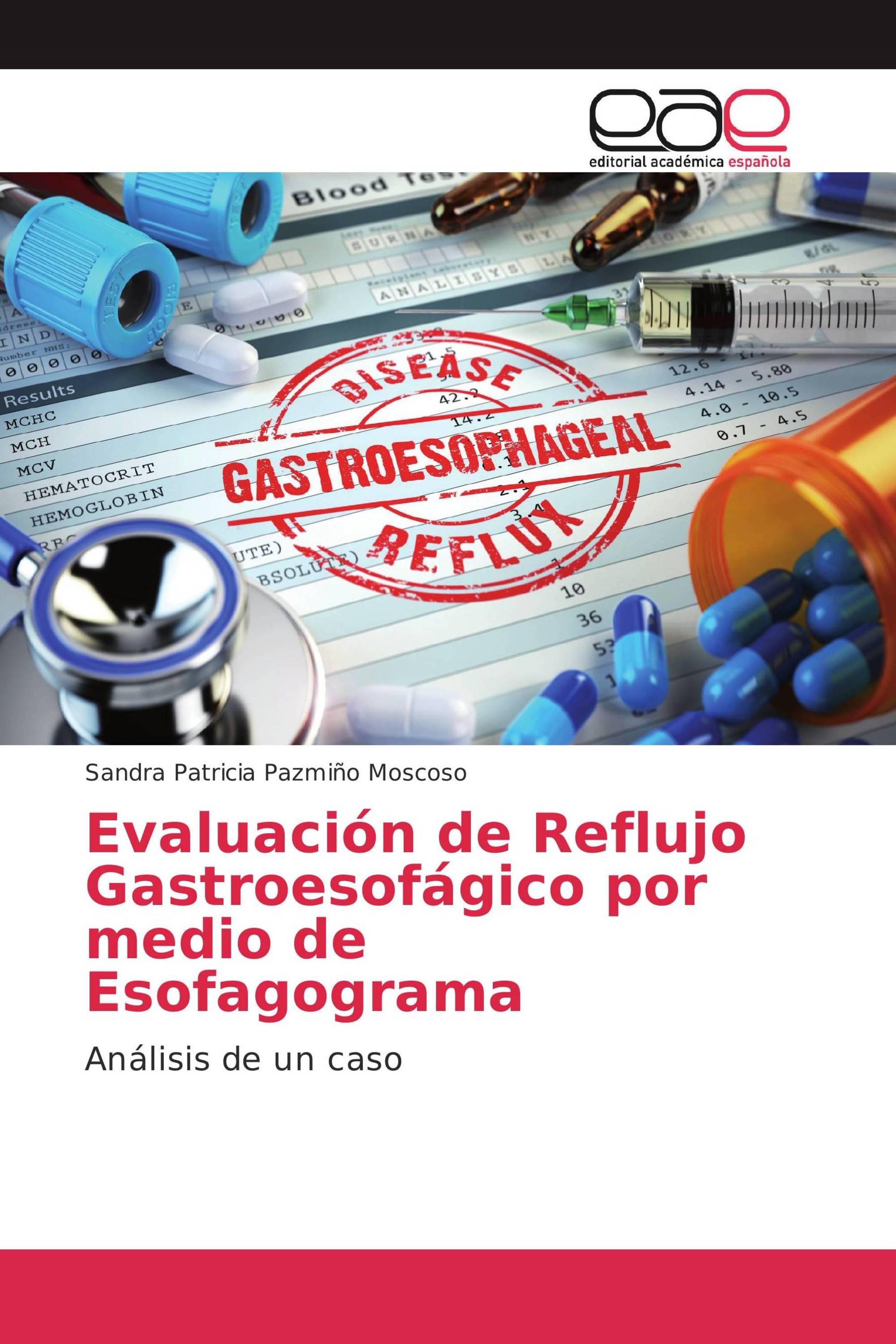 Evaluación de Reflujo Gastroesofágico por medio de Esofagograma