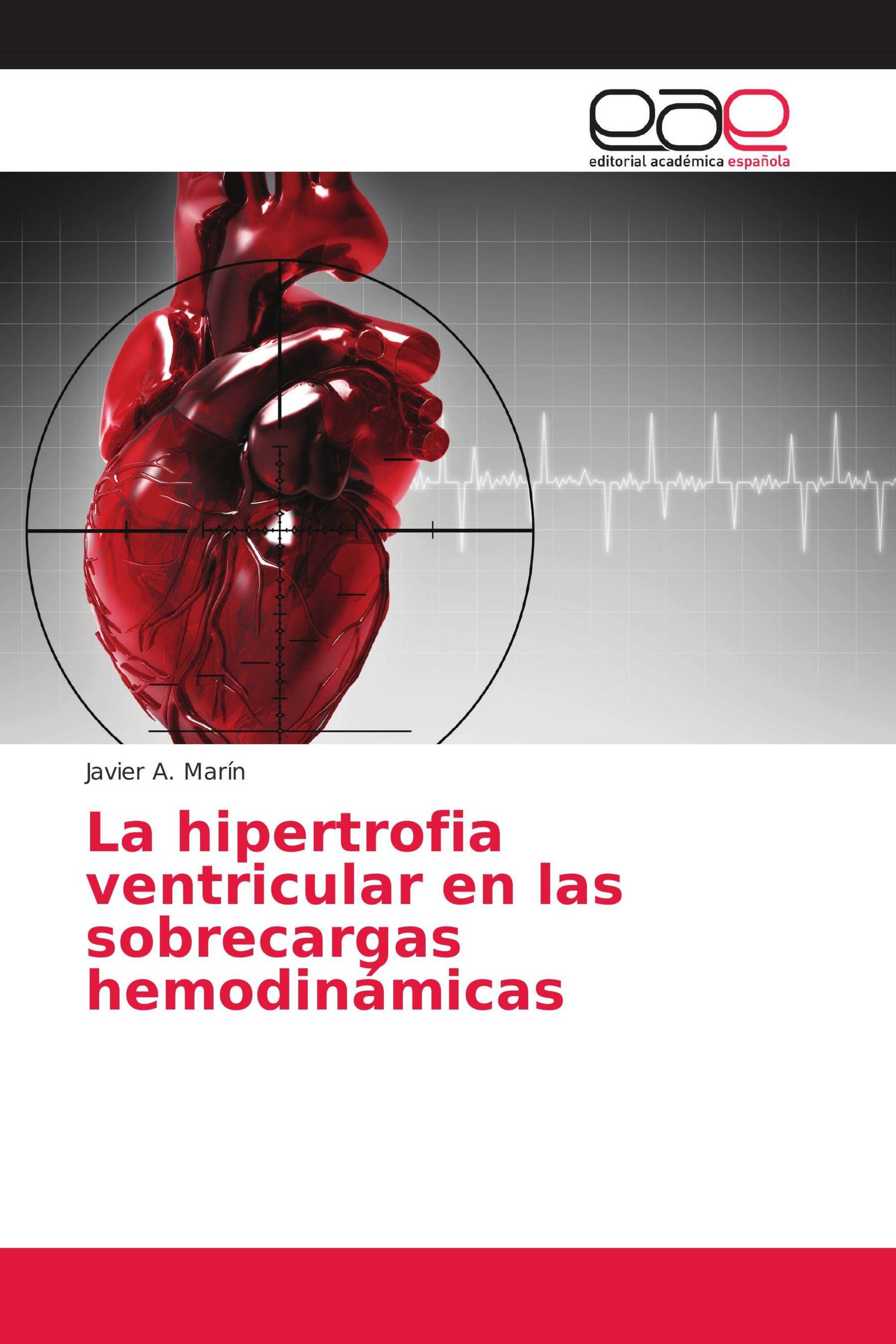 La hipertrofia ventricular en las sobrecargas hemodinámicas