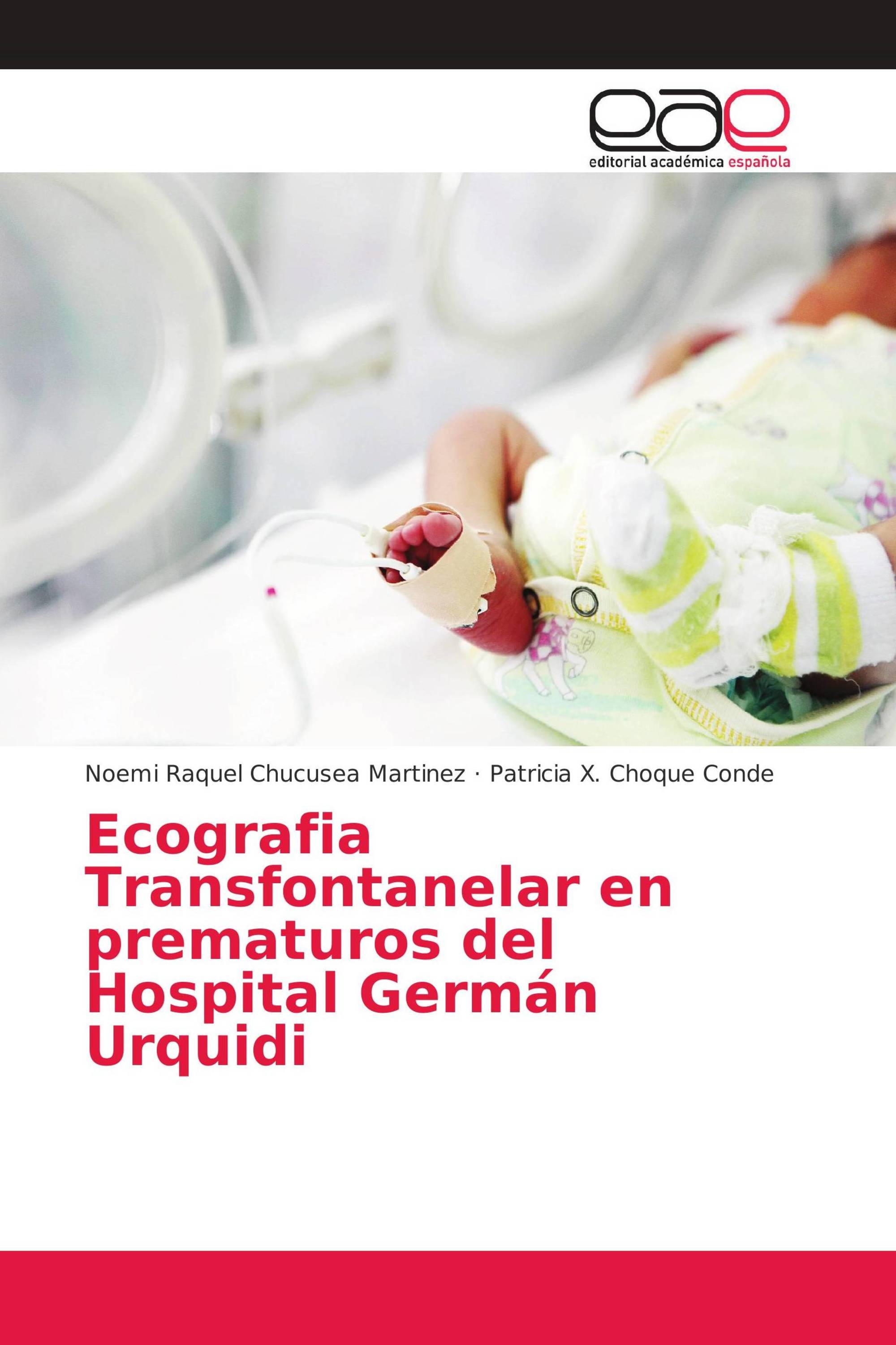 Ecografia Transfontanelar en prematuros del Hospital Germán Urquidi