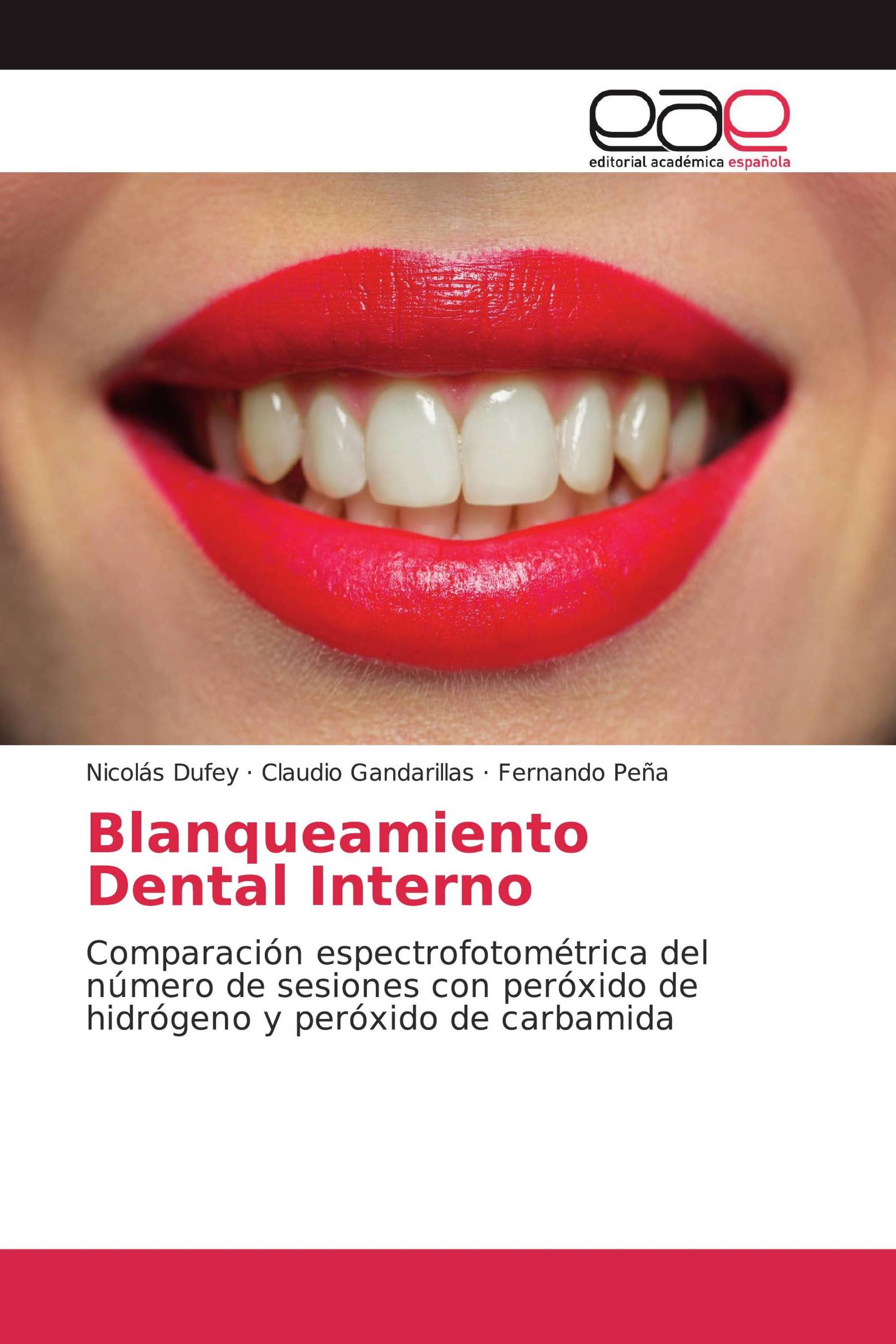 Blanqueamiento Dental Interno