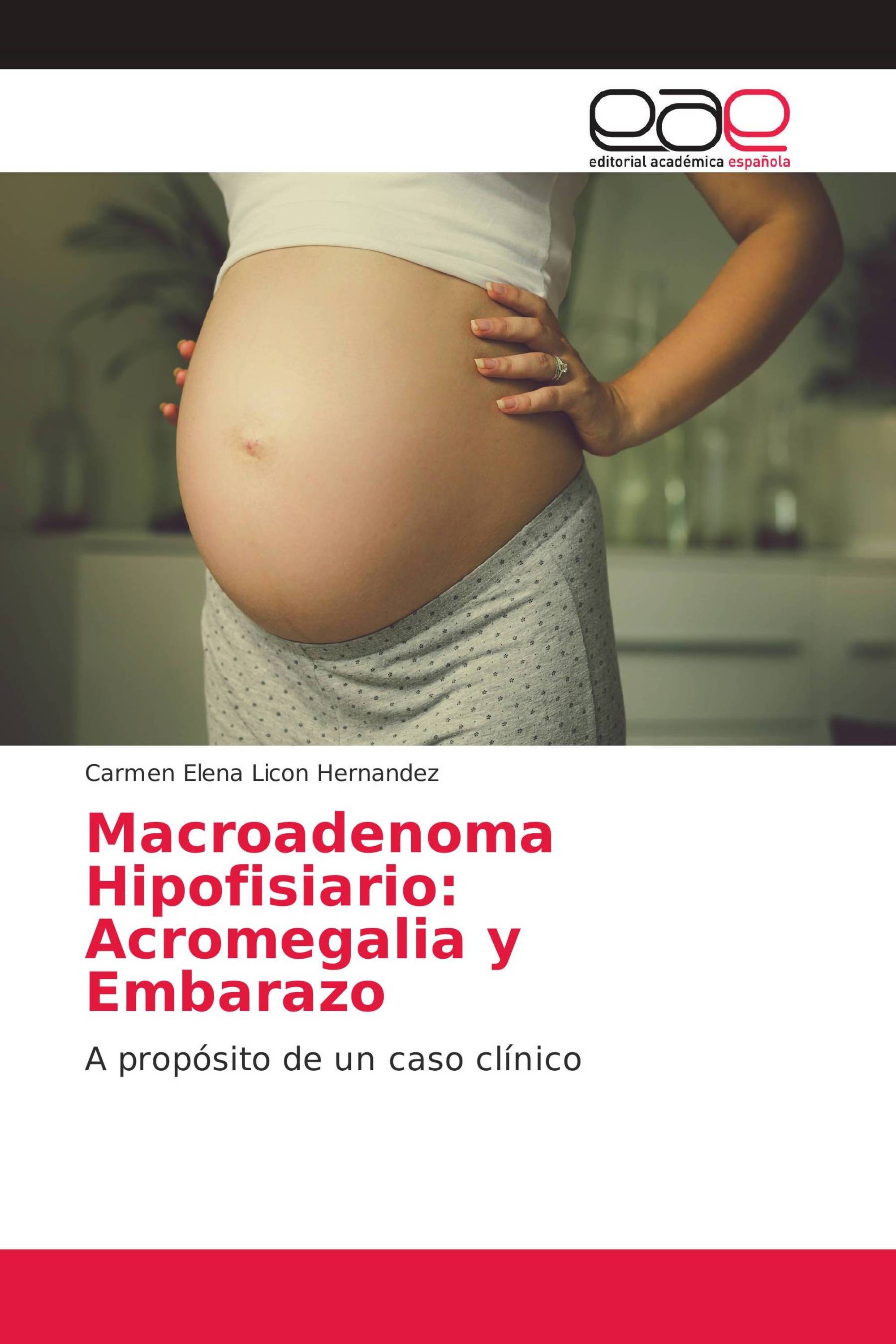 Macroadenoma Hipofisiario: Acromegalia y Embarazo