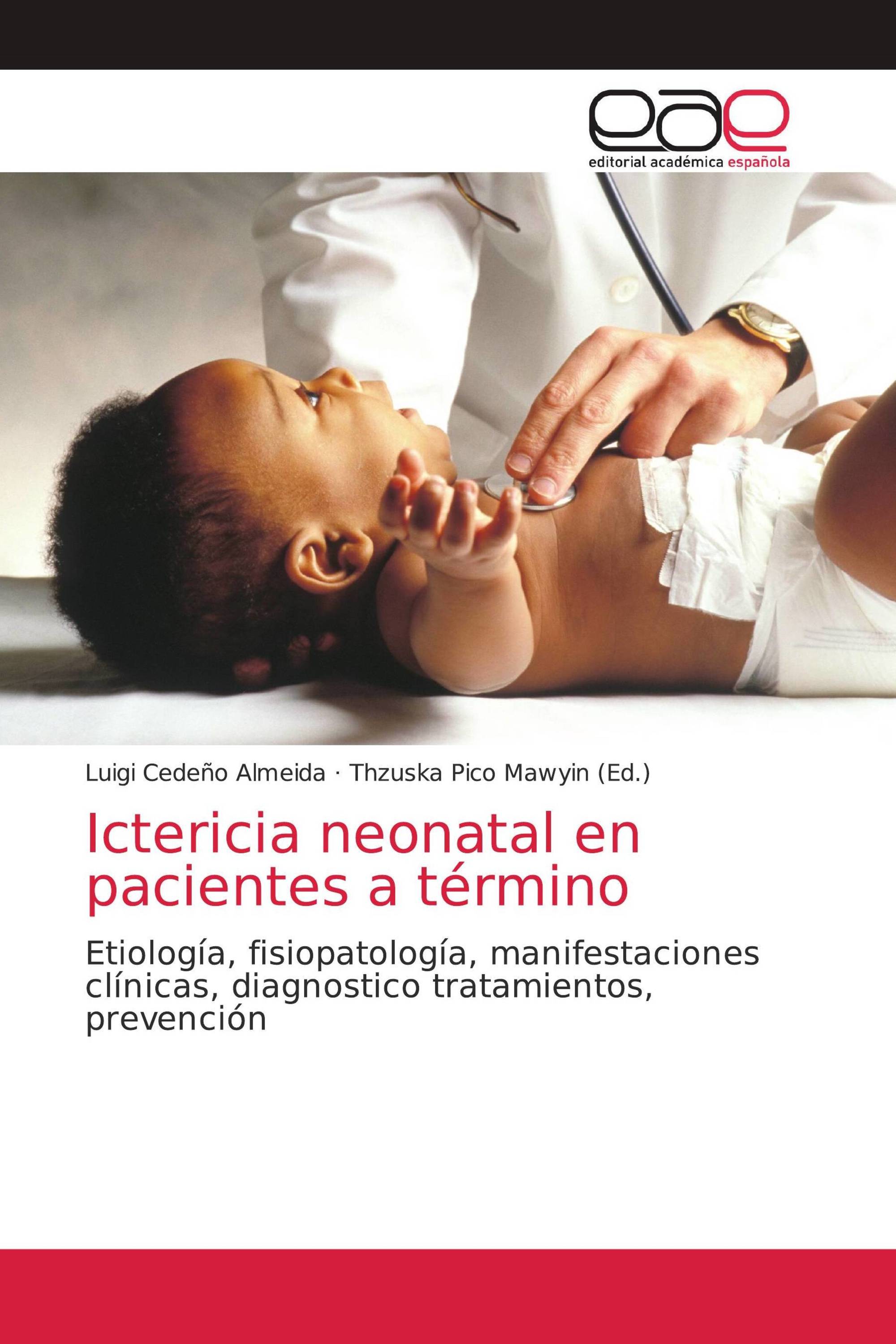 Ictericia neonatal en pacientes a término