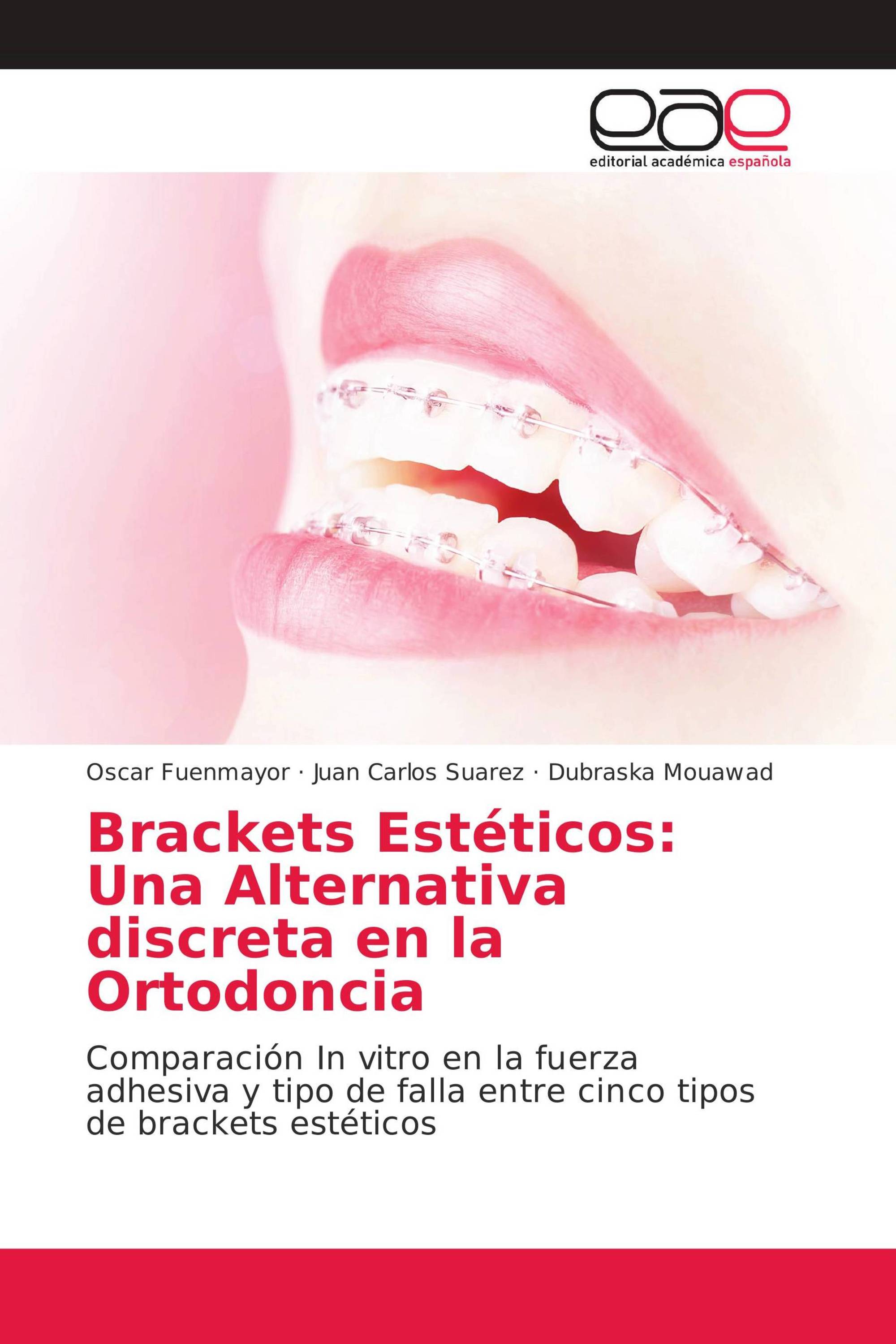 Brackets Estéticos: Una Alternativa discreta en la Ortodoncia