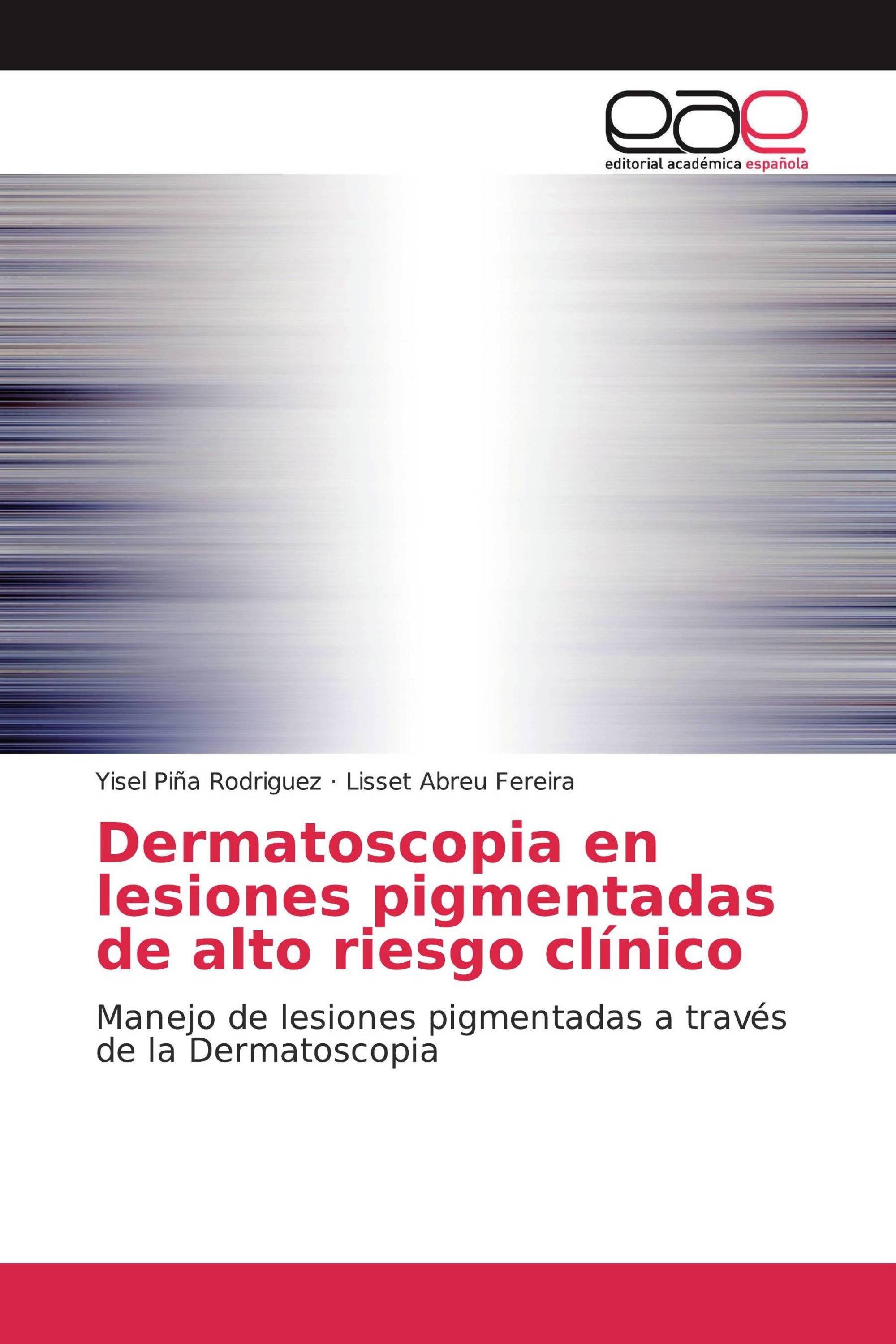 Dermatoscopia en lesiones pigmentadas de alto riesgo clínico