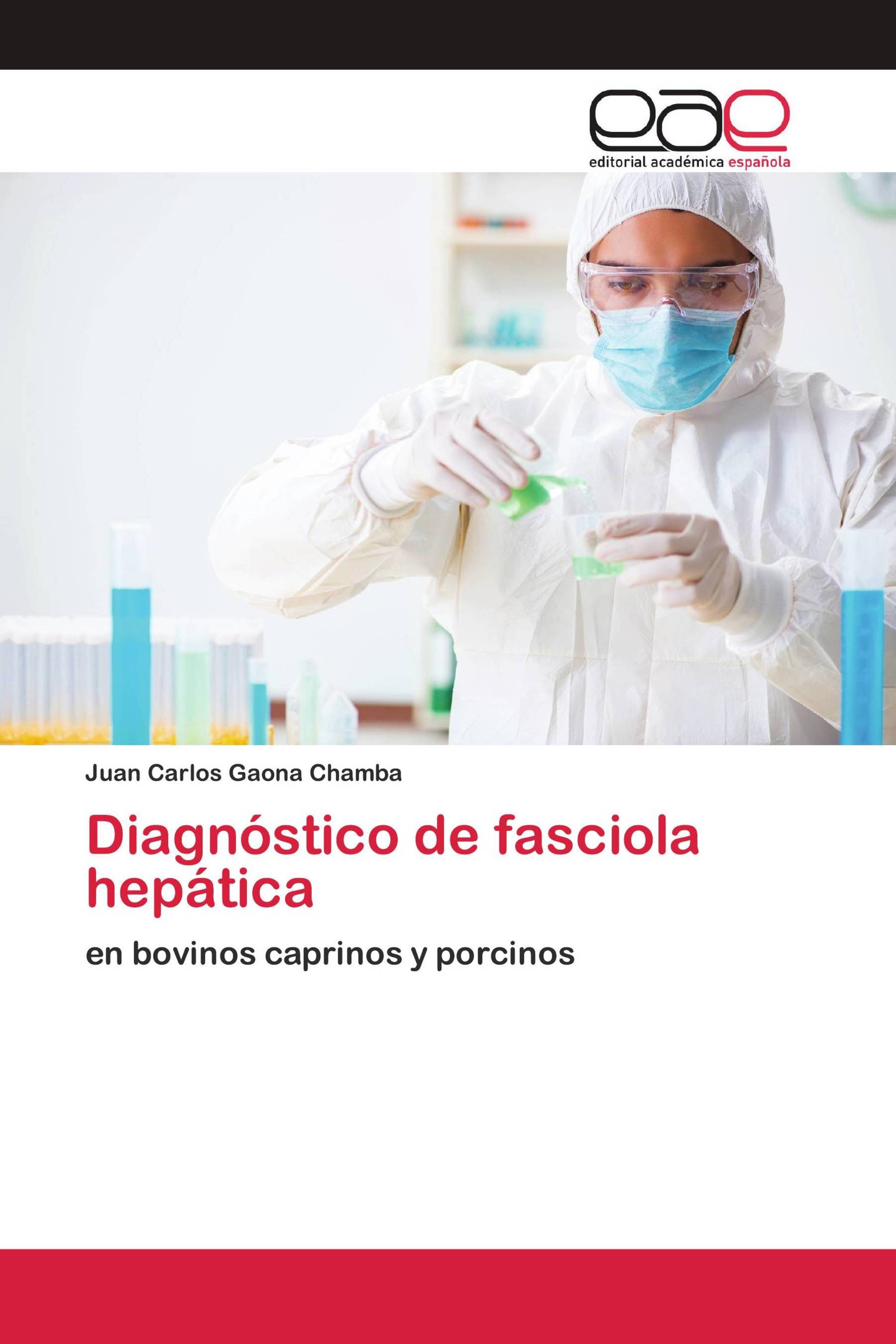 Diagnóstico de fasciola hepática