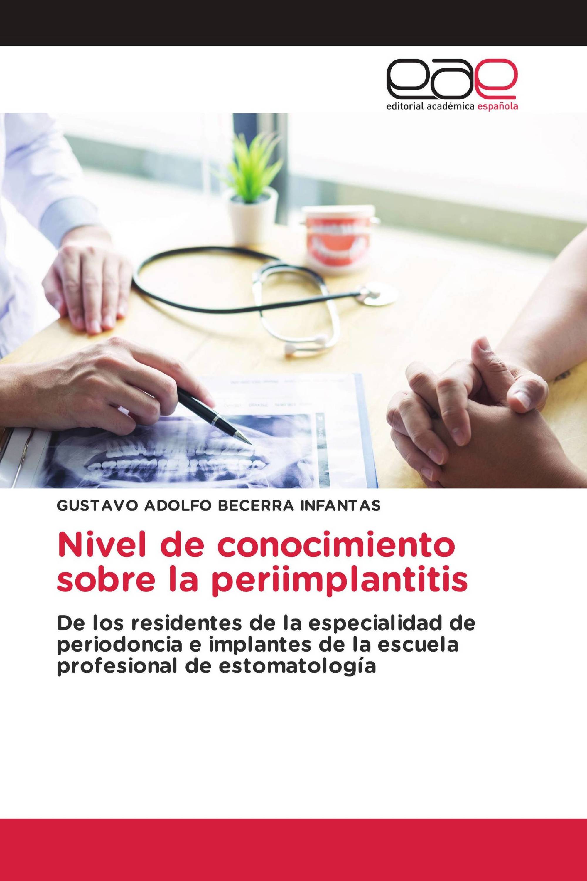 Nivel de conocimiento sobre la periimplantitis