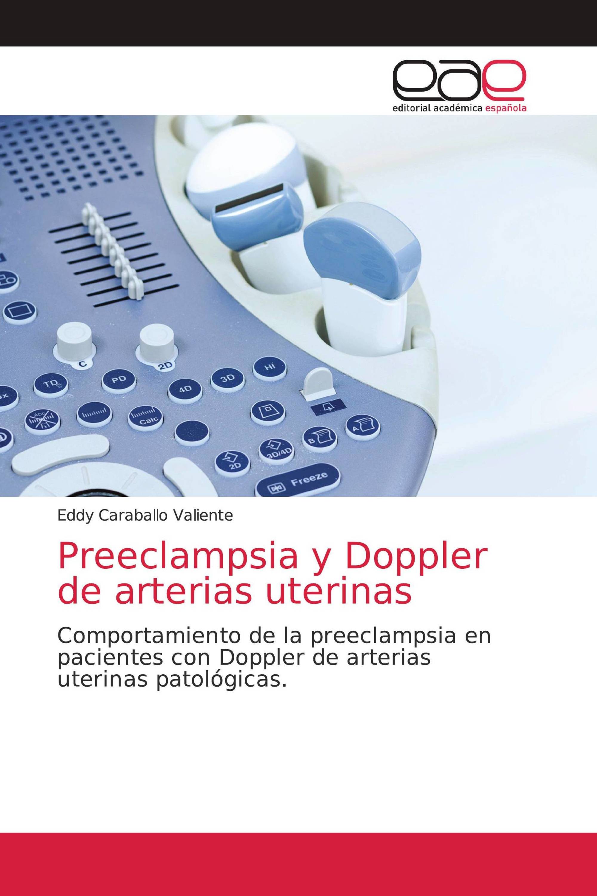 Preeclampsia y Doppler de arterias uterinas