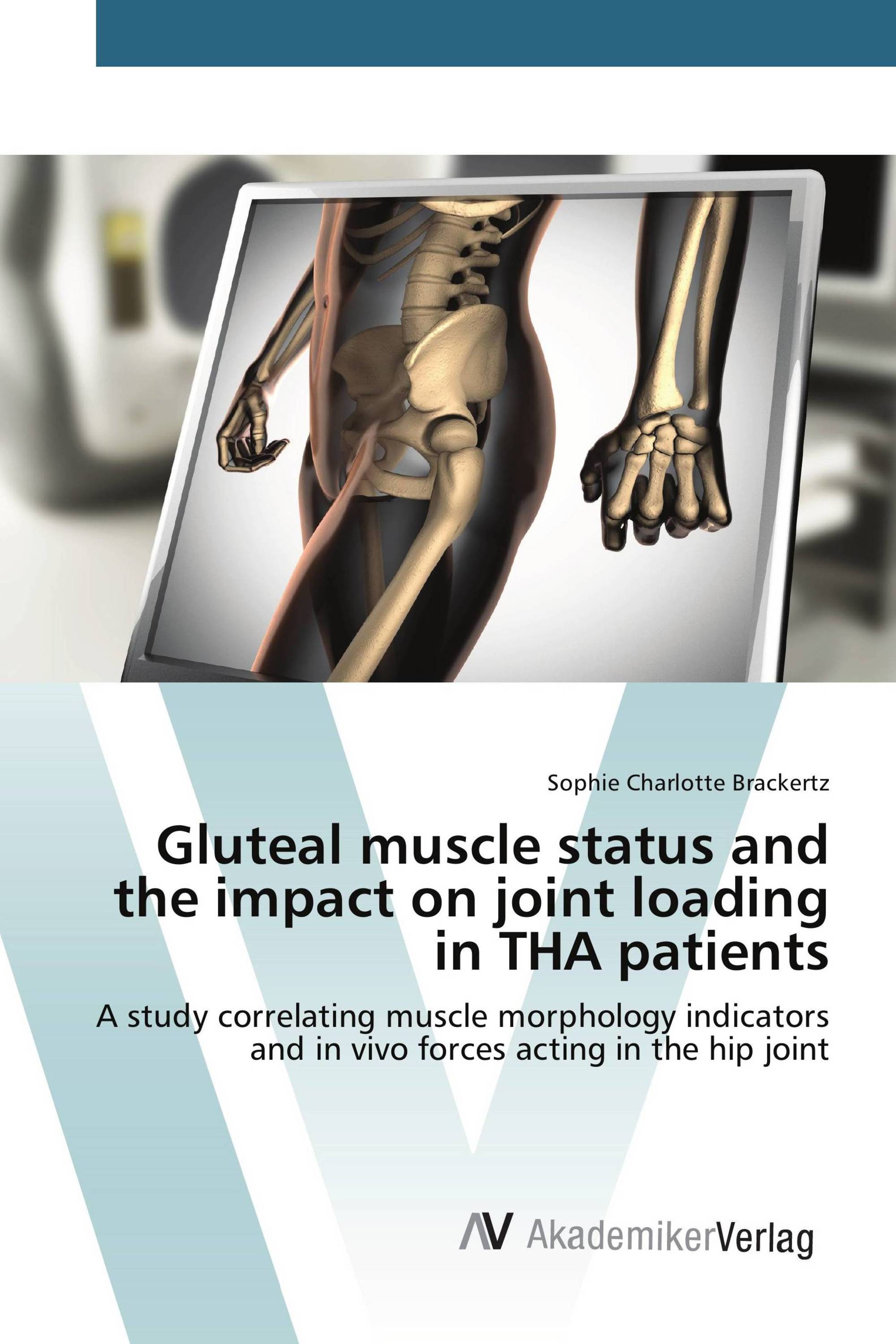 Gluteal muscle status and the impact on joint loading in THA patients