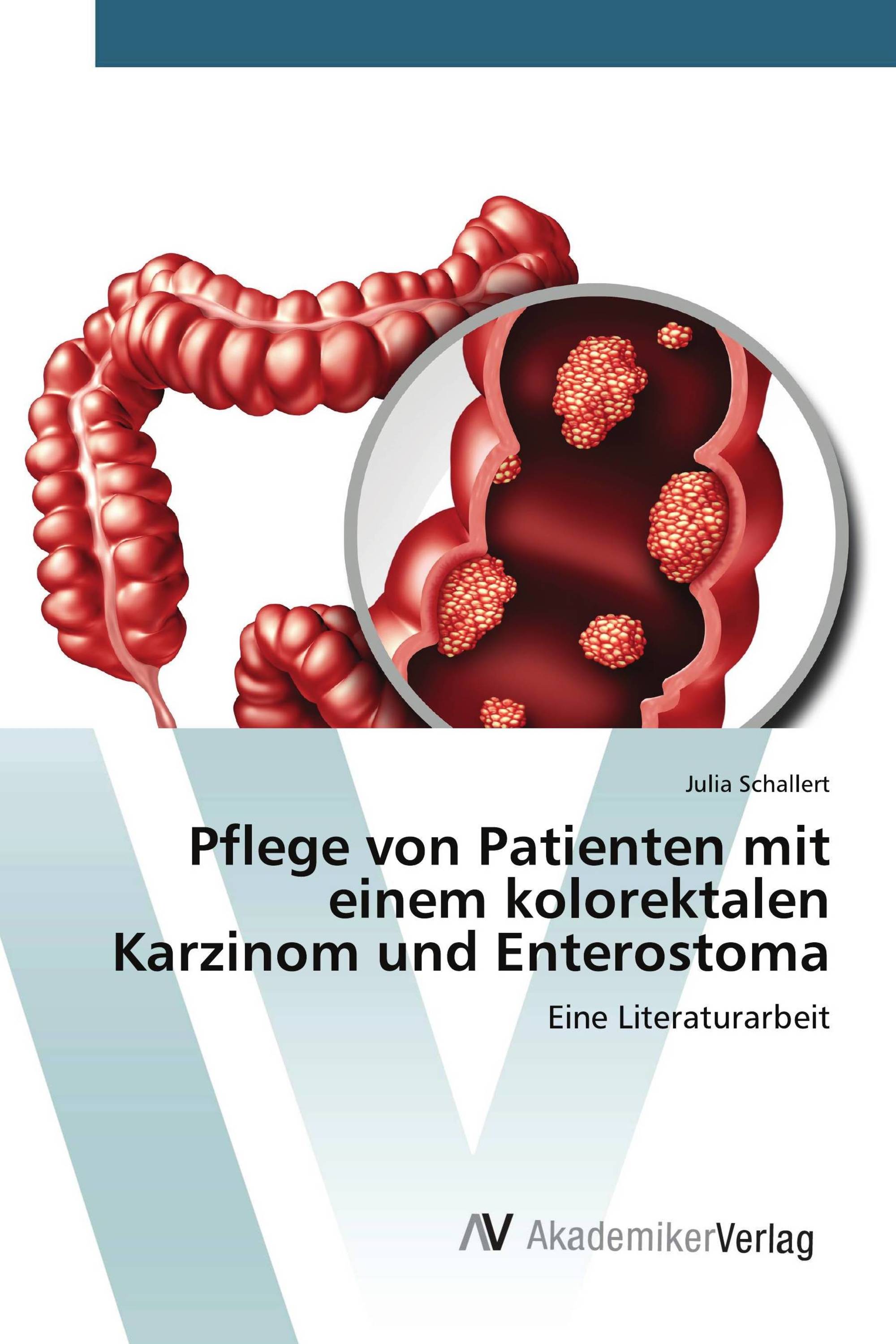 Pflege von Patienten mit einem kolorektalen Karzinom und Enterostoma