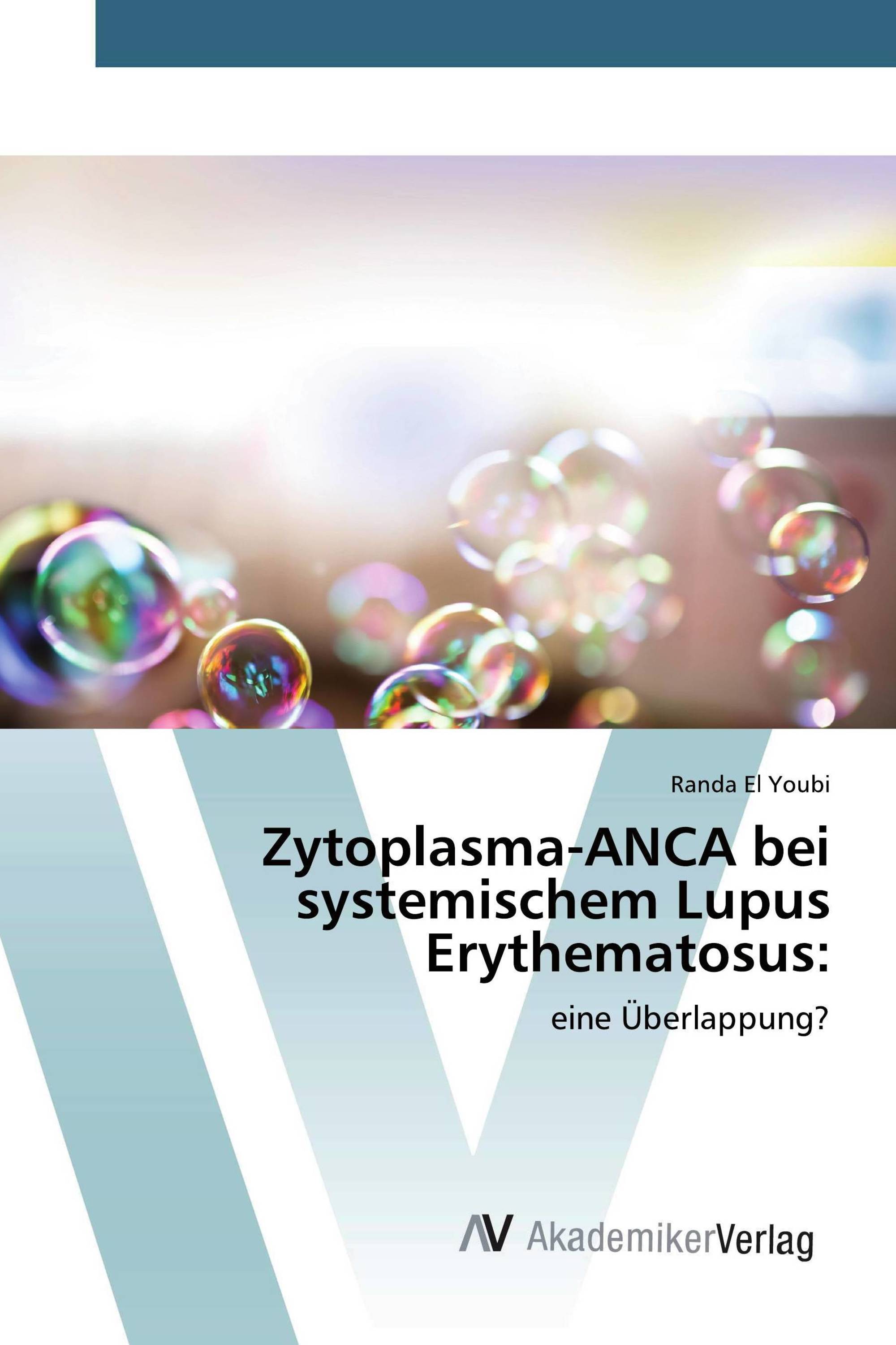 Zytoplasma-ANCA bei systemischem Lupus Erythematosus: