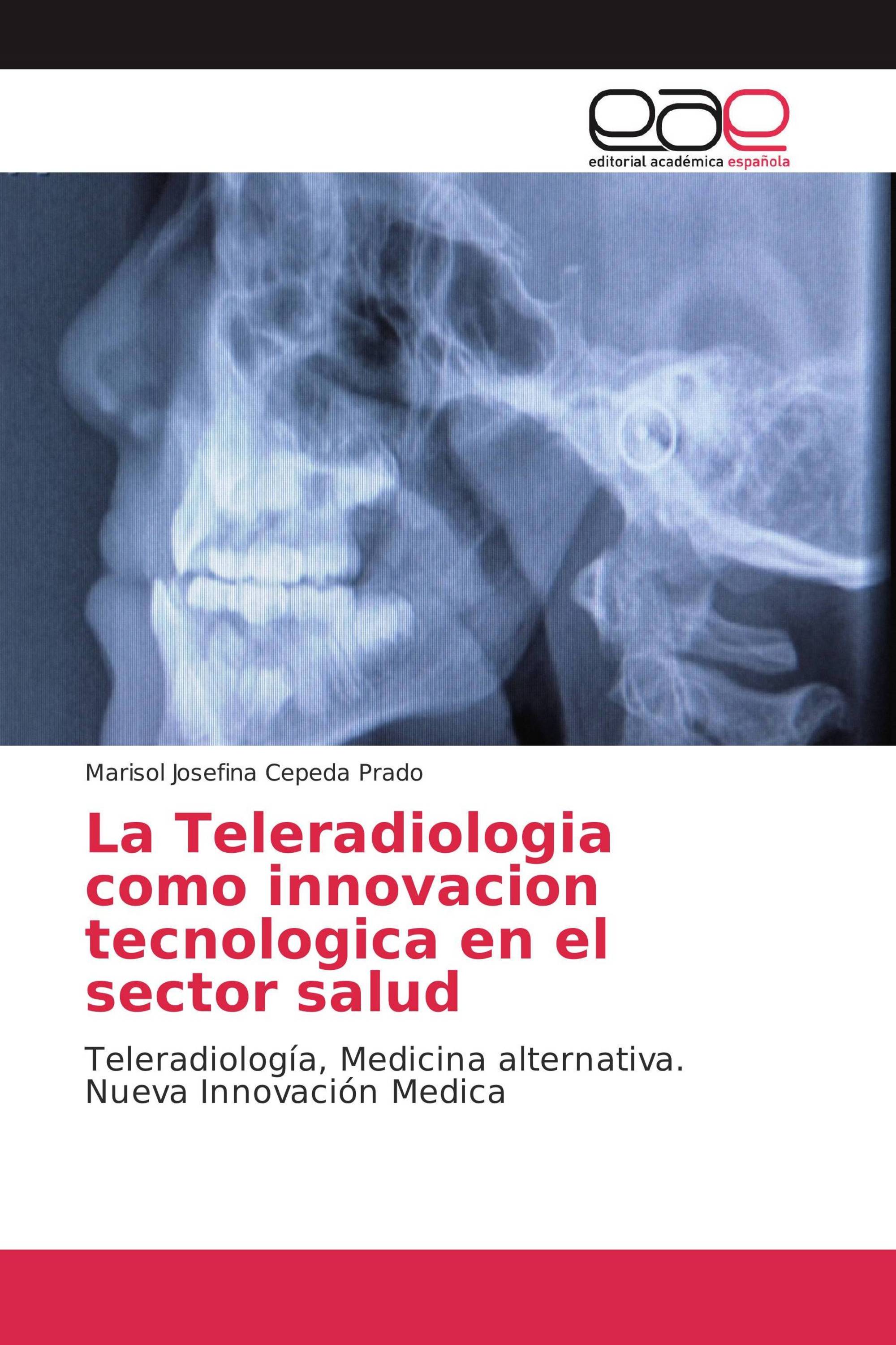 La Teleradiologia como innovacion tecnologica en el sector salud