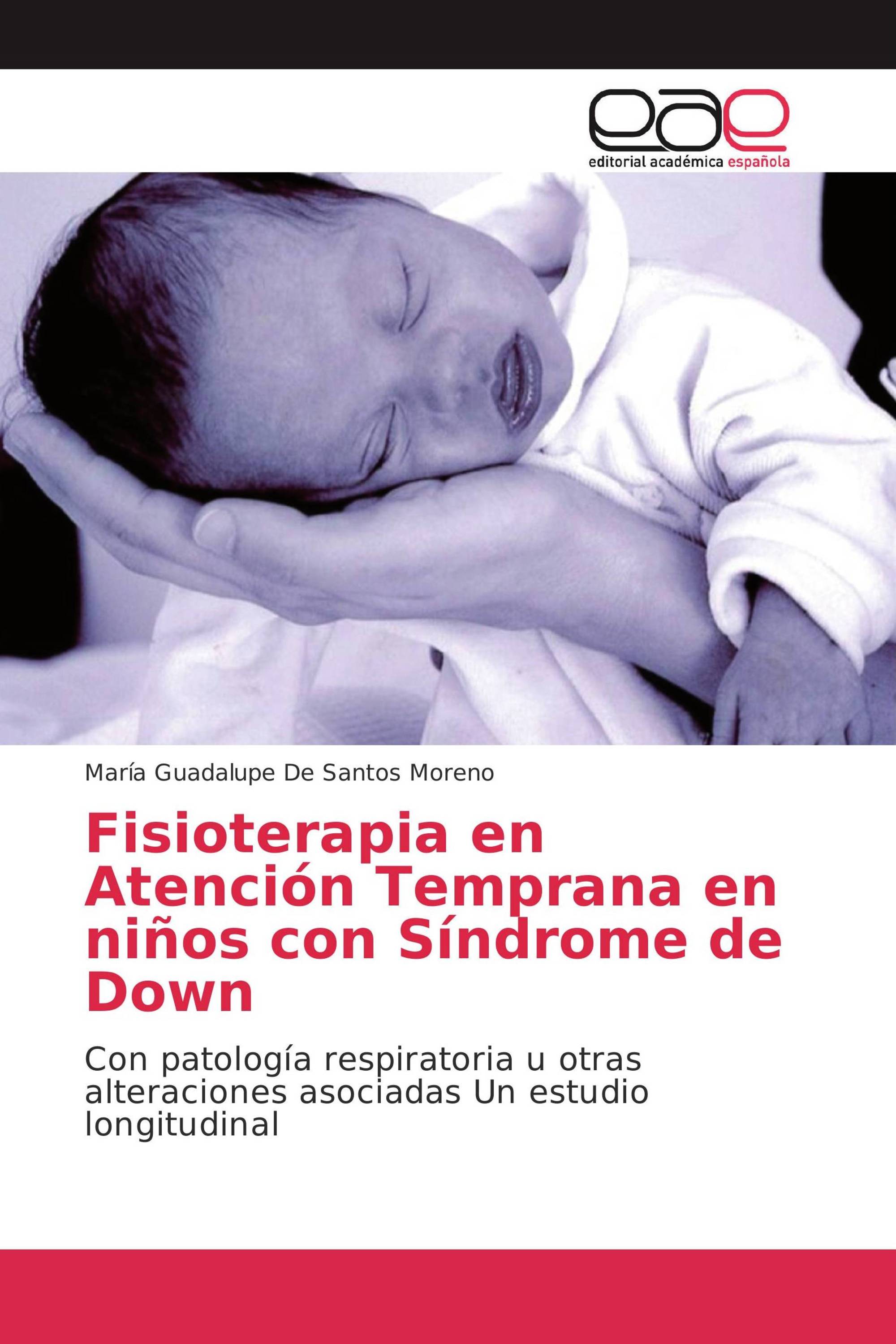 Fisioterapia en Atención Temprana en niños con Síndrome de Down