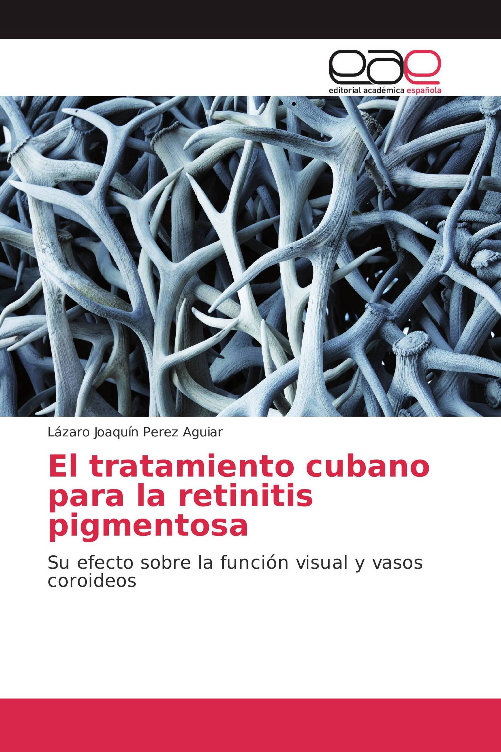 El tratamiento cubano para la retinitis pigmentosa