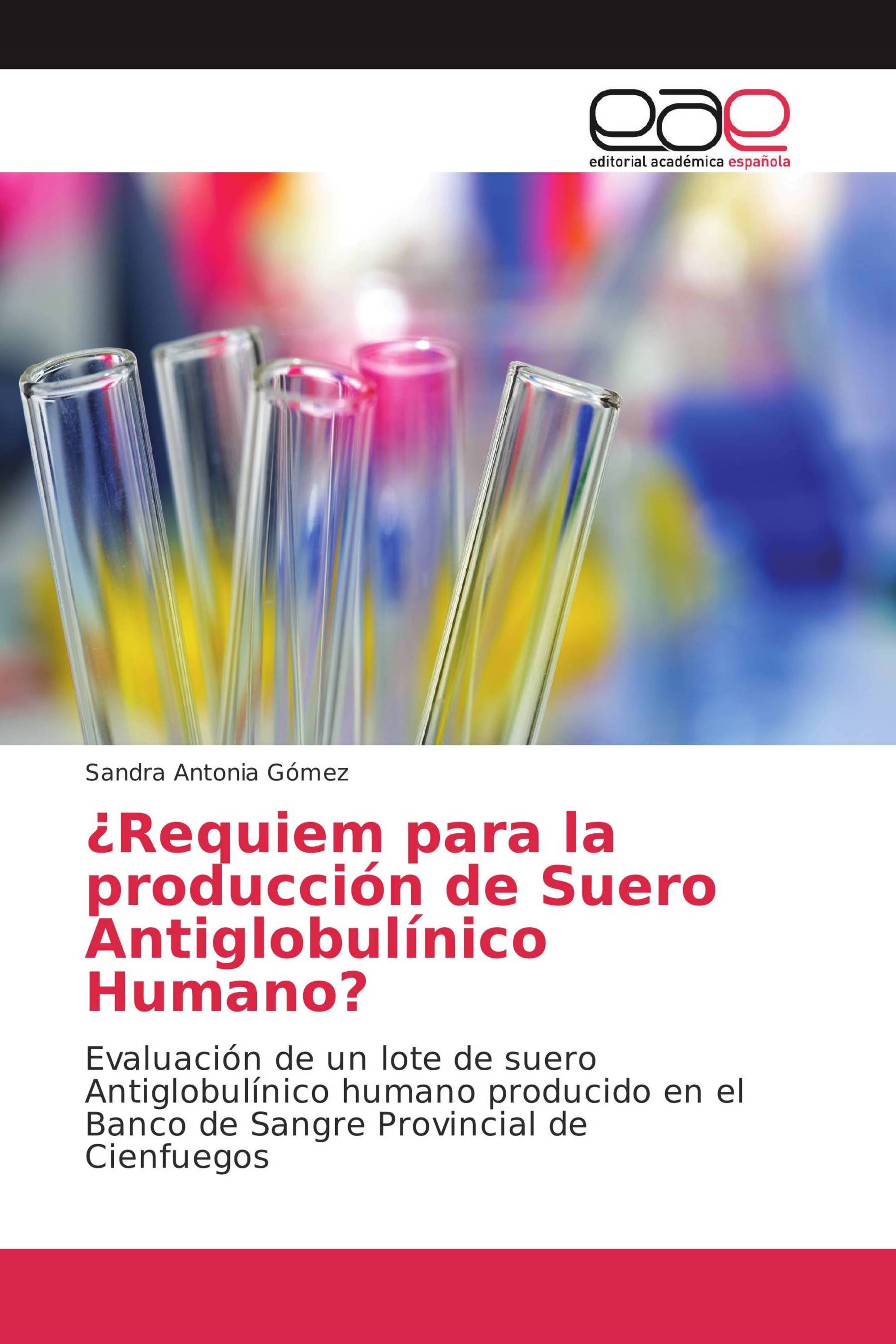 ¿Requiem para la producción de Suero Antiglobulínico Humano?