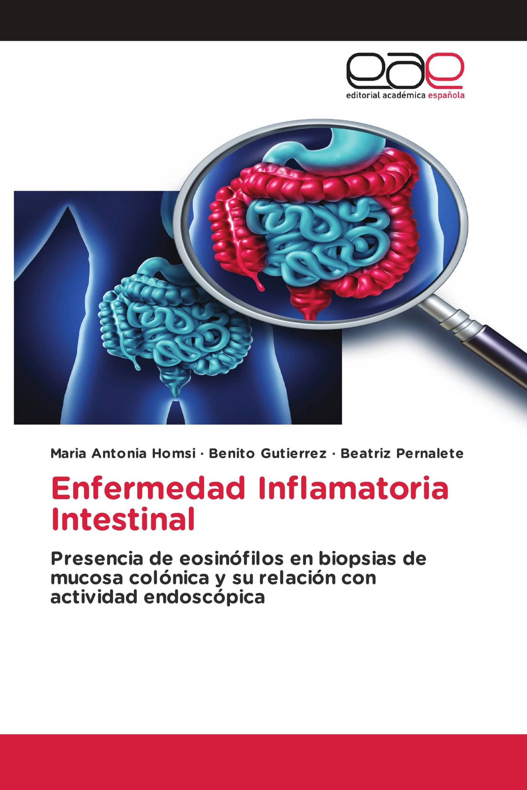 Enfermedad Inflamatoria Intestinal Semejanzas Y Diferencias Porn Sex Picture