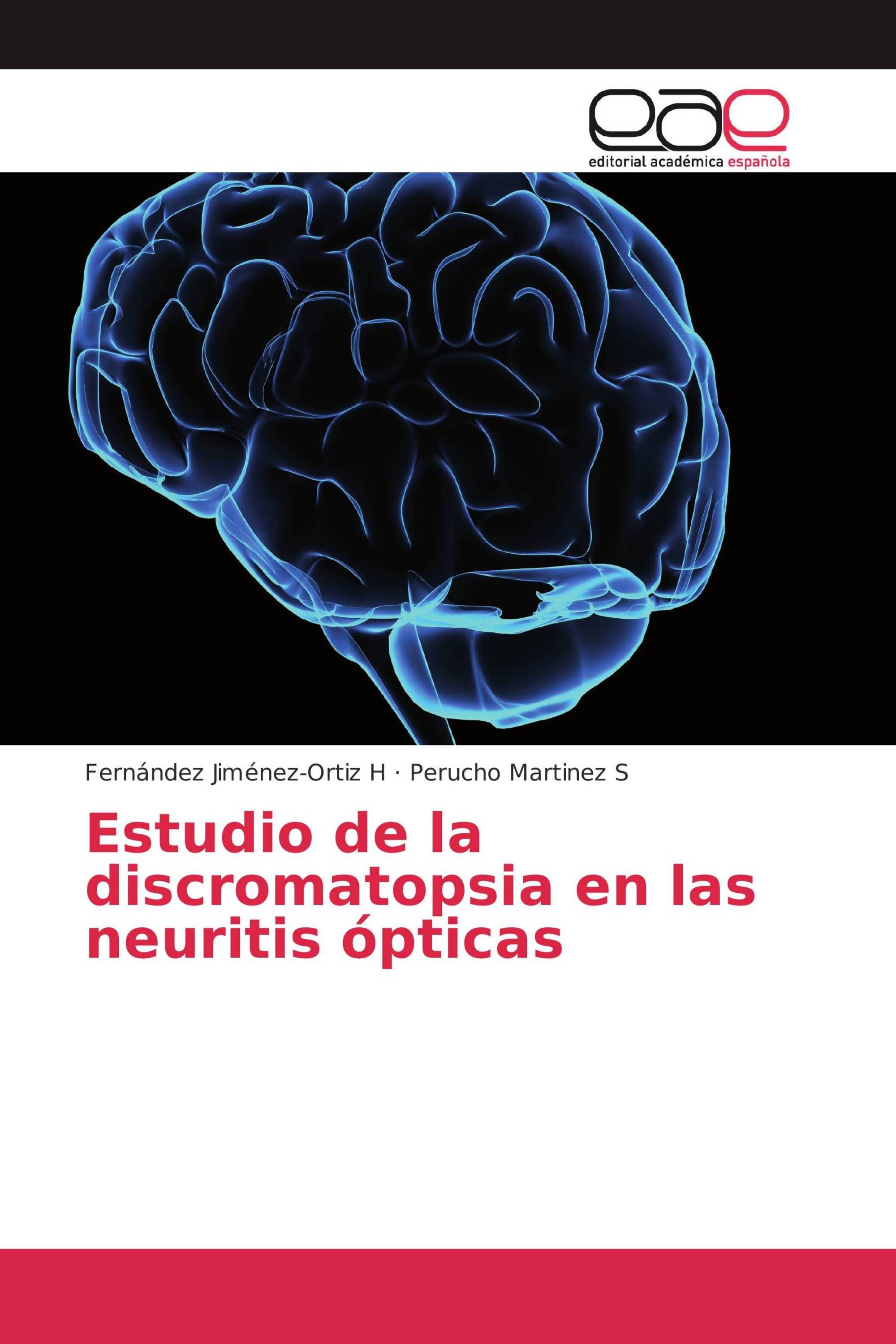 Estudio de la discromatopsia en las neuritis ópticas