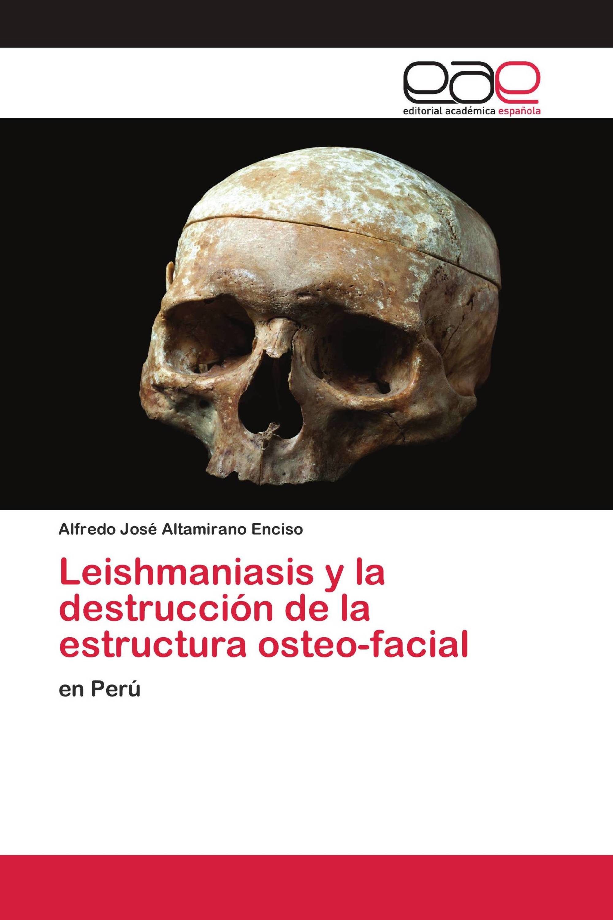 Leishmaniasis y la destrucción de la estructura osteo-facial