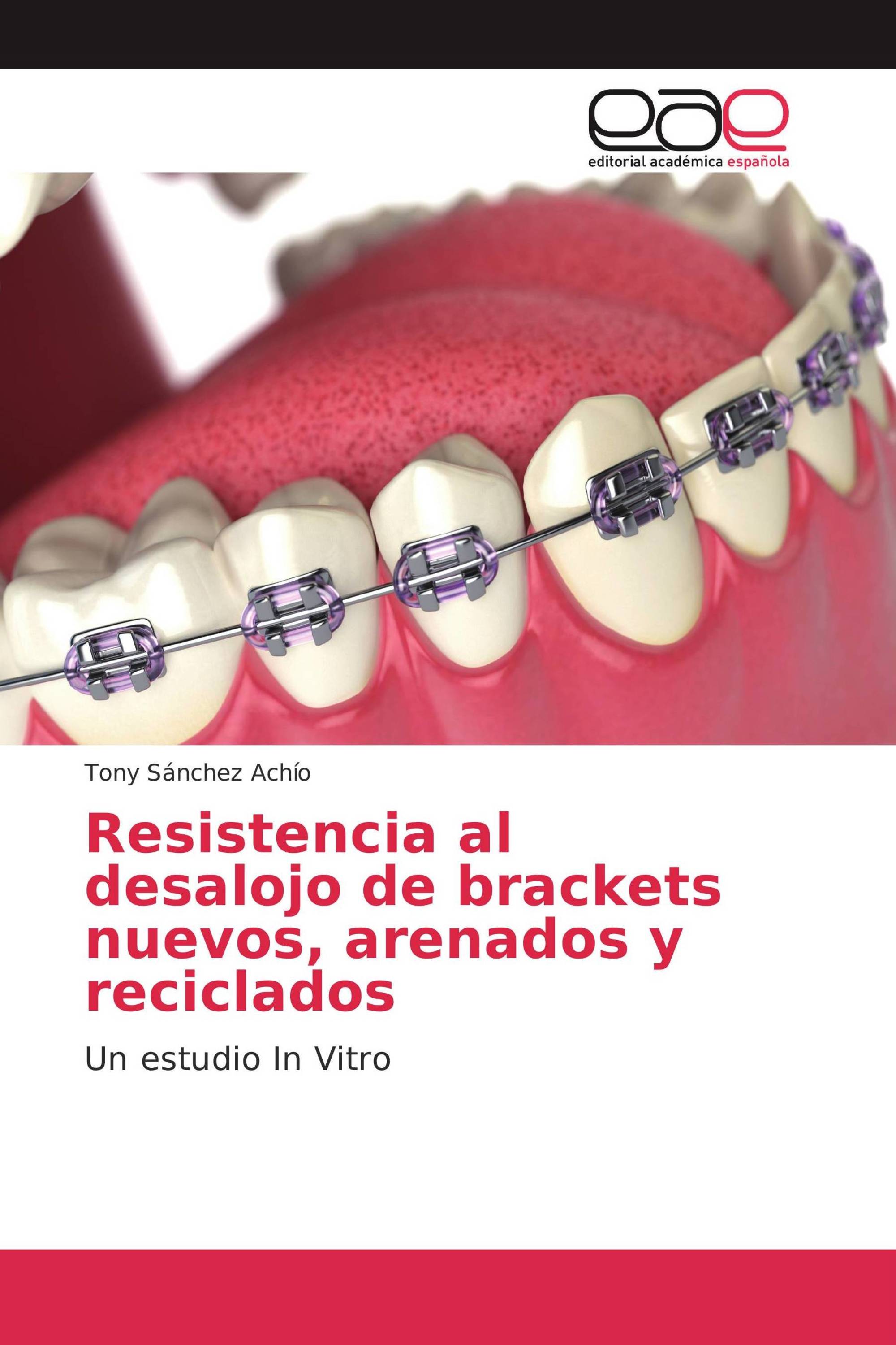 Resistencia al desalojo de brackets nuevos, arenados y reciclados