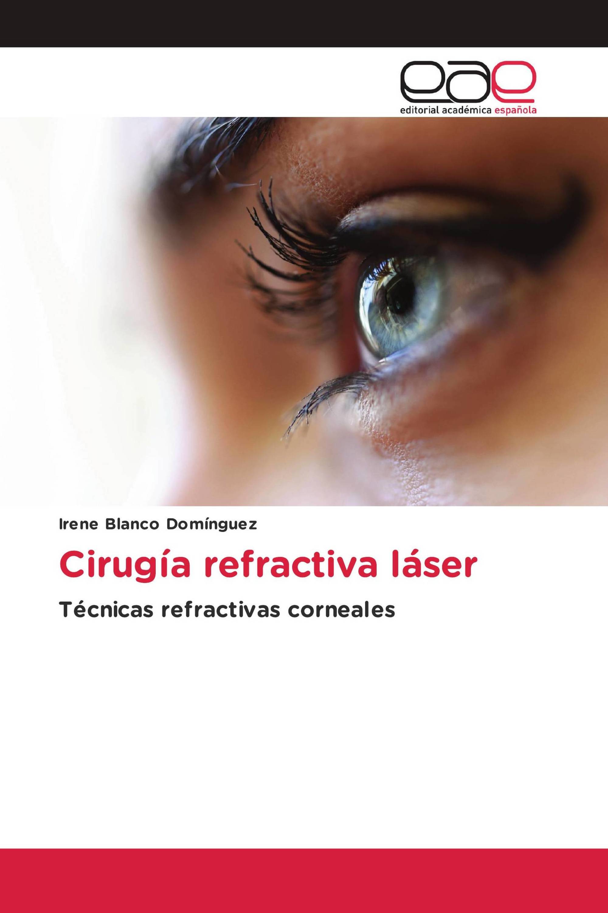 Cirugía refractiva láser