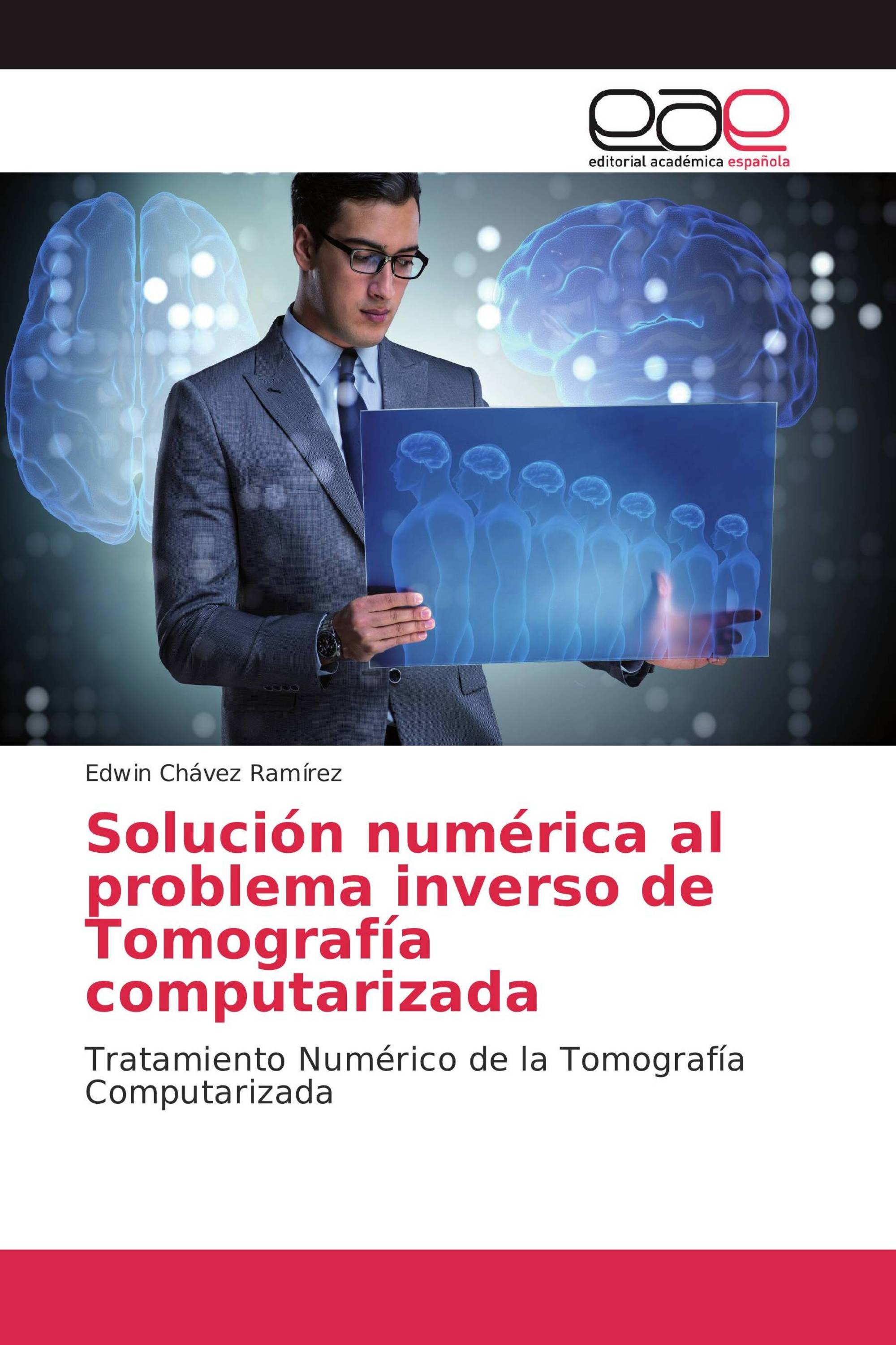 Solución numérica al problema inverso de Tomografía computarizada