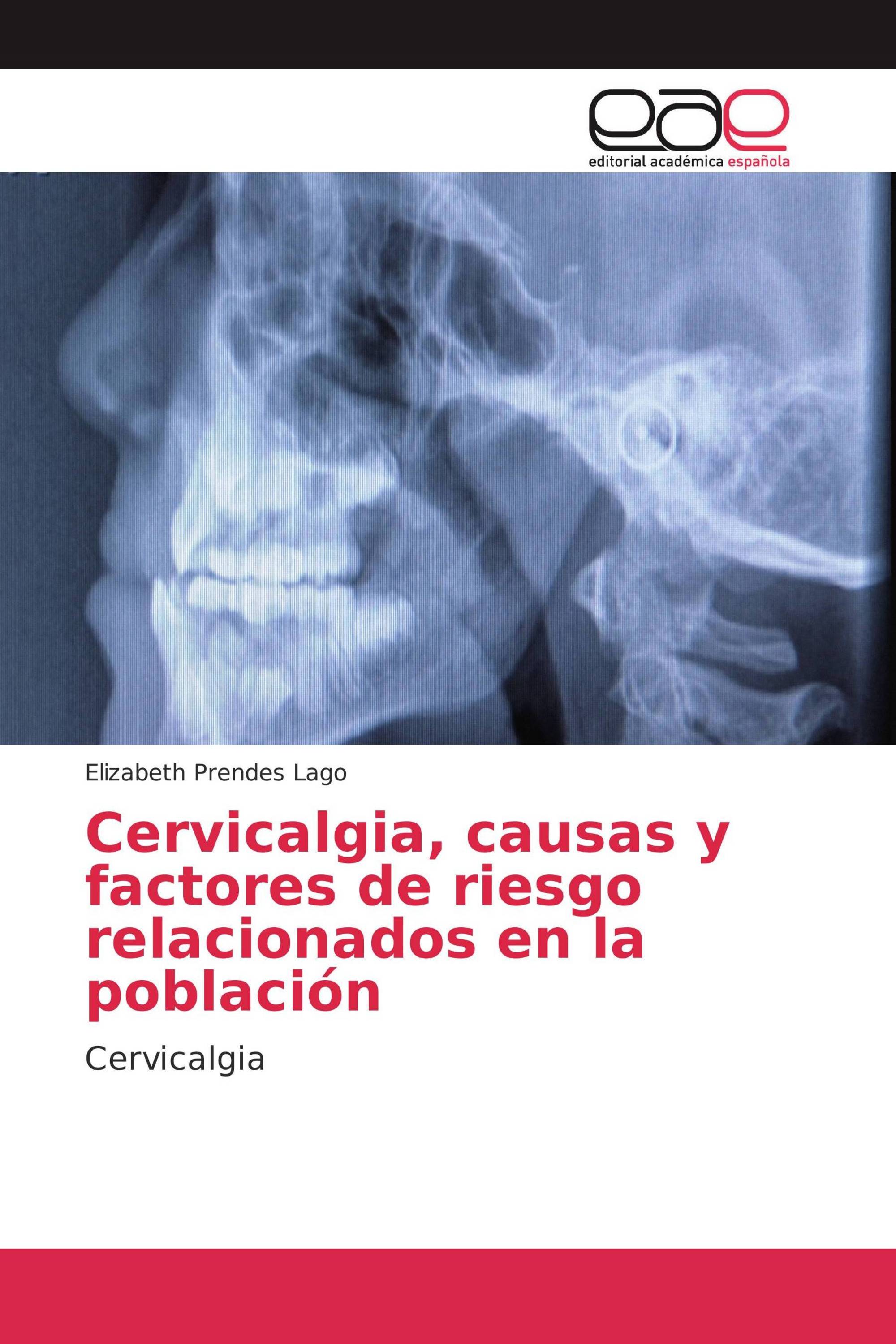 Cervicalgia, causas y factores de riesgo relacionados en la población