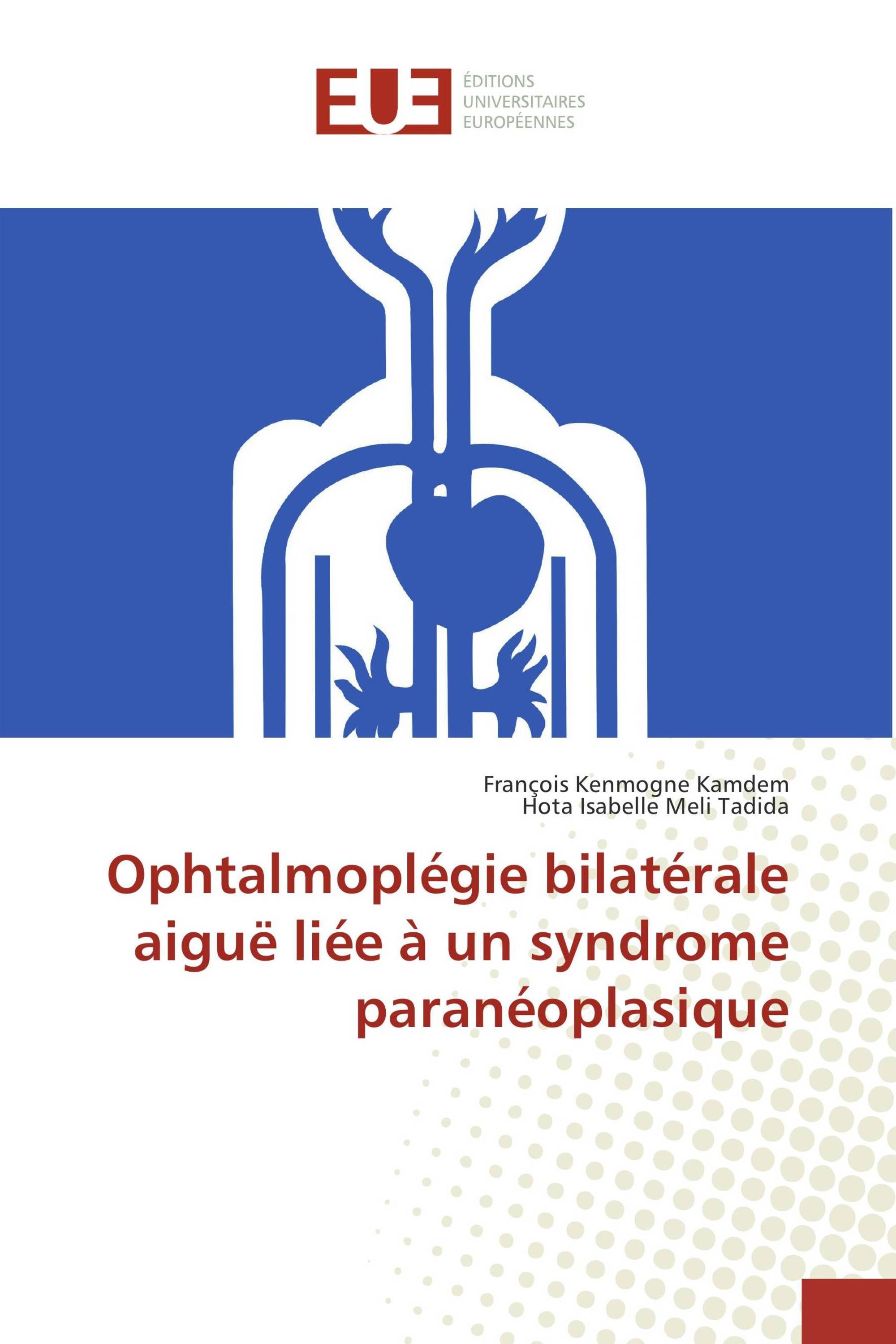 Ophtalmoplégie bilatérale aiguë liée à un syndrome paranéoplasique